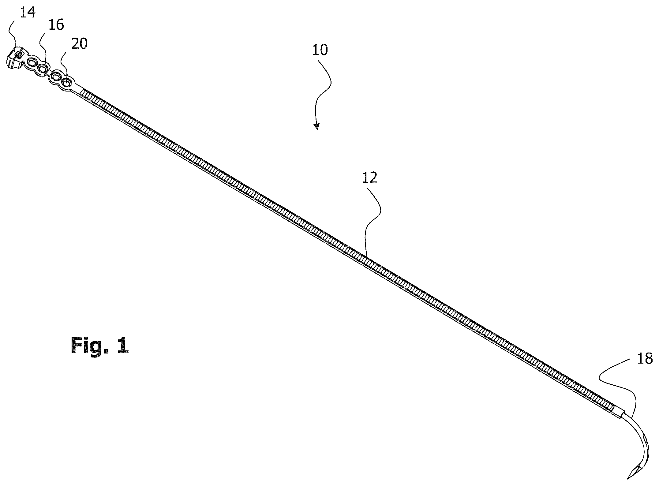 Patent US12396772 Figure 1 – Implant for bone fixation