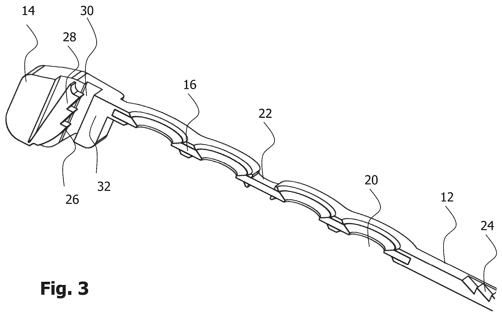 Patent US12396772 Figure 3 – Implant for bone fixation