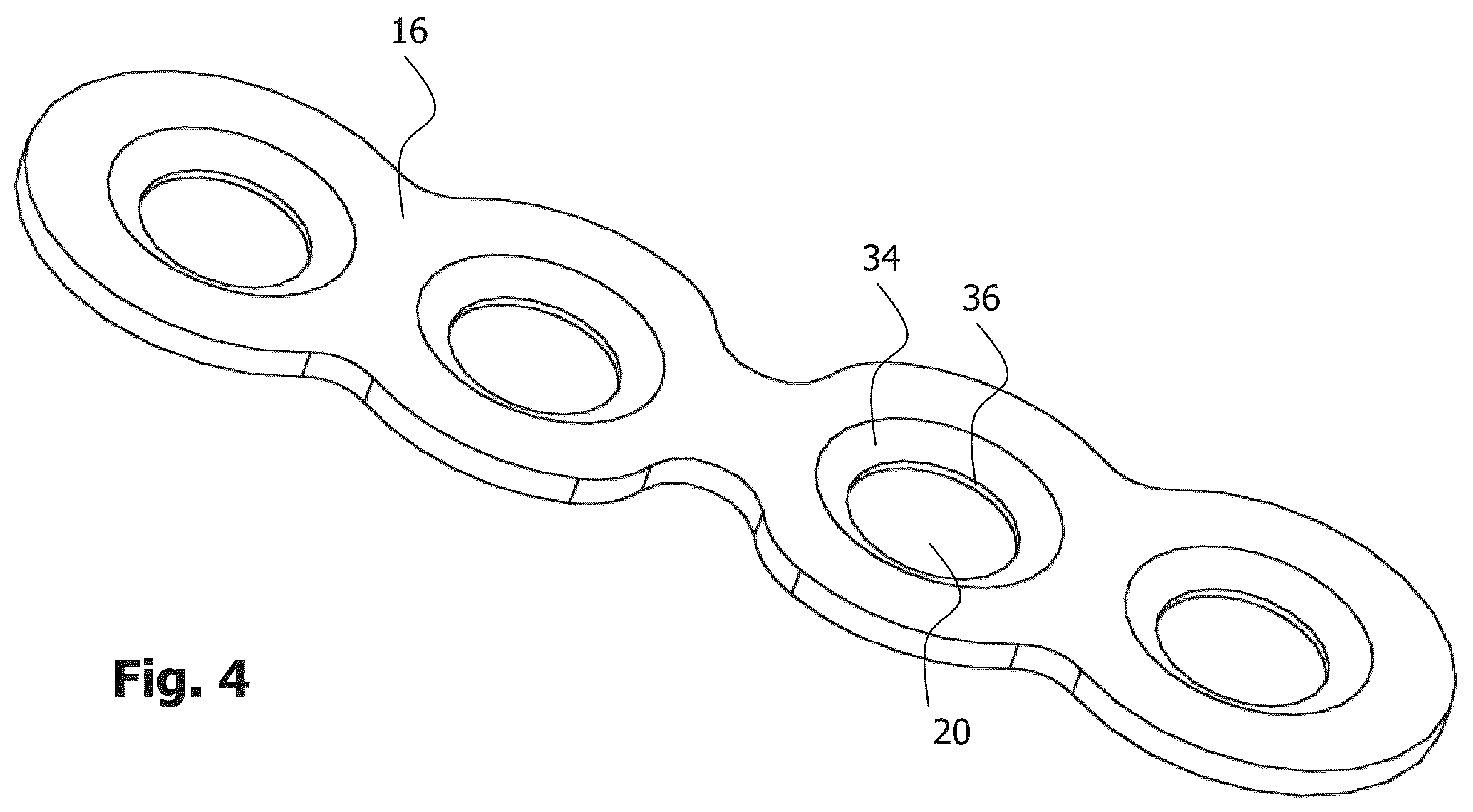 Patent US12396772 Figure 4 – Implant for bone fixation