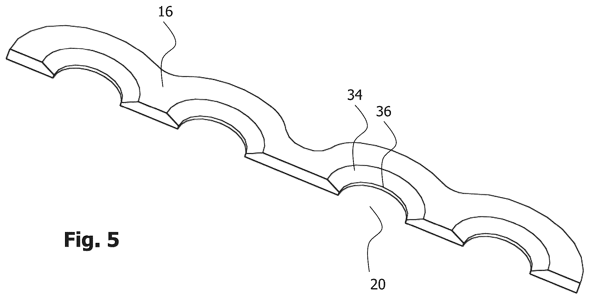 Patent US12396772 Figure 5 – Implant for bone fixation