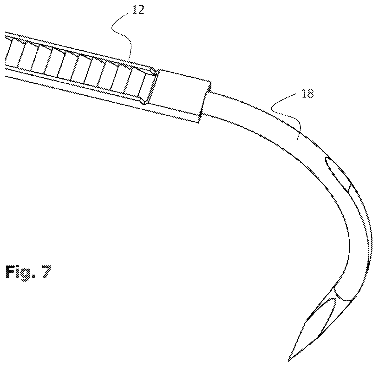 Patent US12396772 Figure 7 – Implant for bone fixation