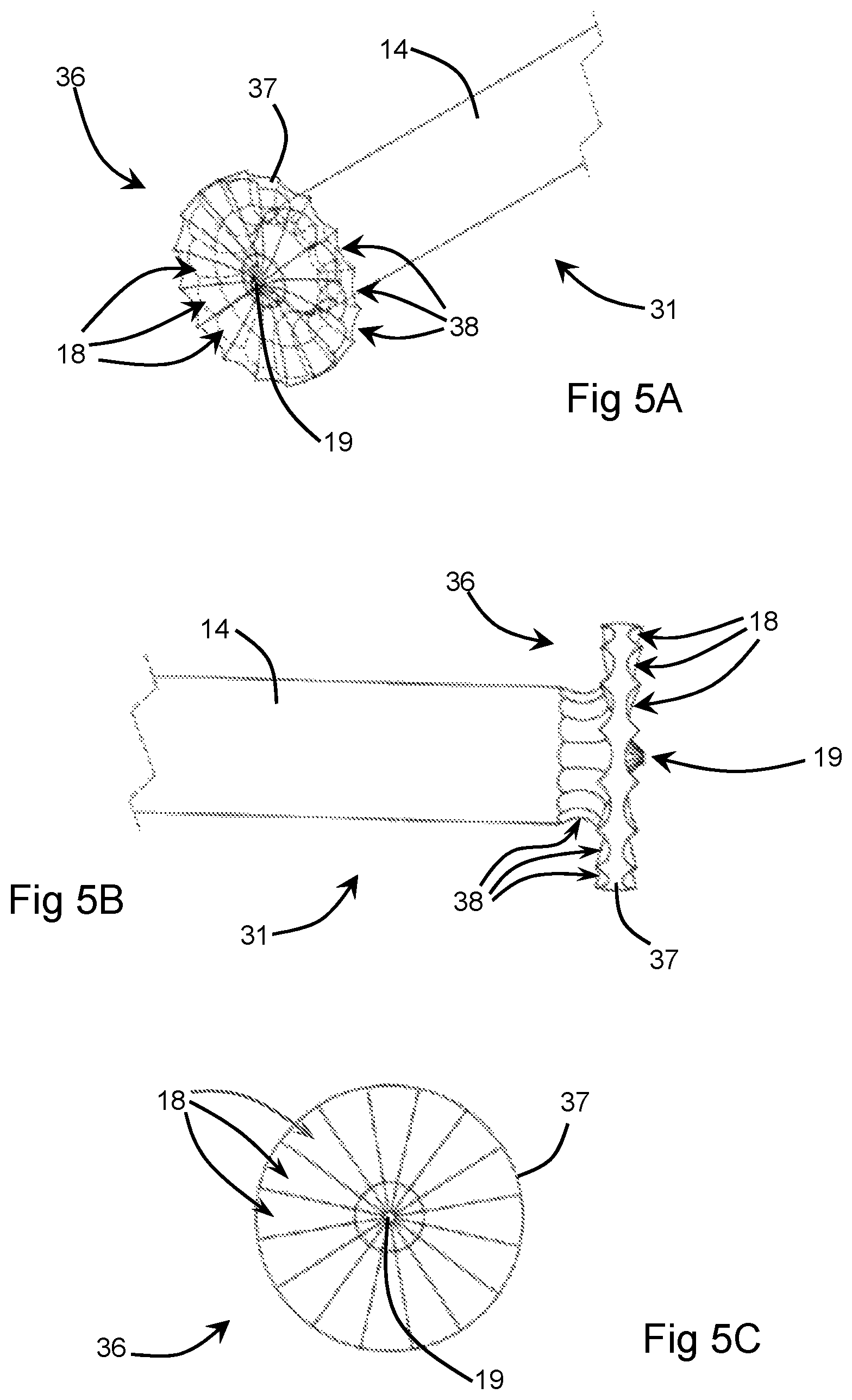 Patent US12396774 Figure 4 – Orthopaedic cement removal tools and method