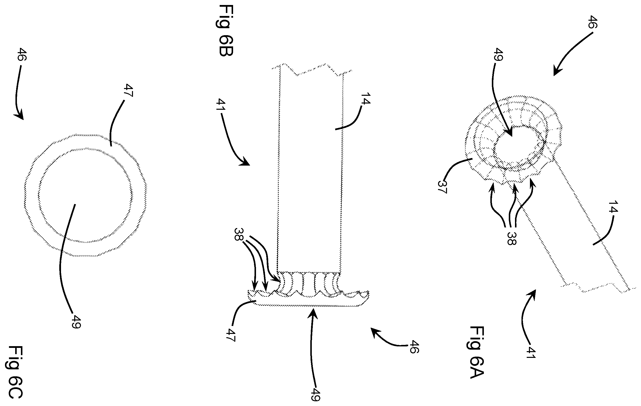 Patent US12396774 Figure 5 – Orthopaedic cement removal tools and method
