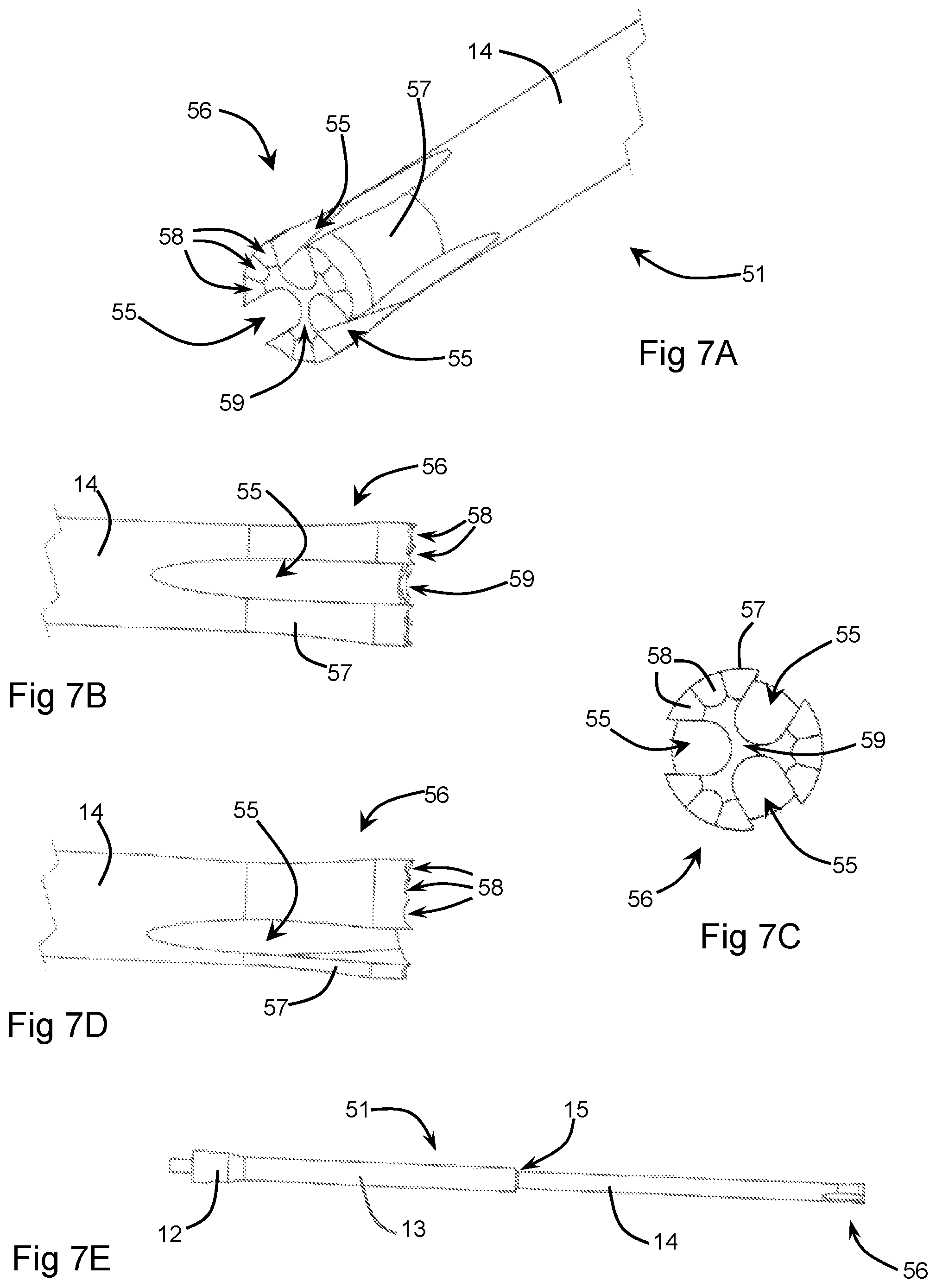 Patent US12396774 Figure 6 – Orthopaedic cement removal tools and method