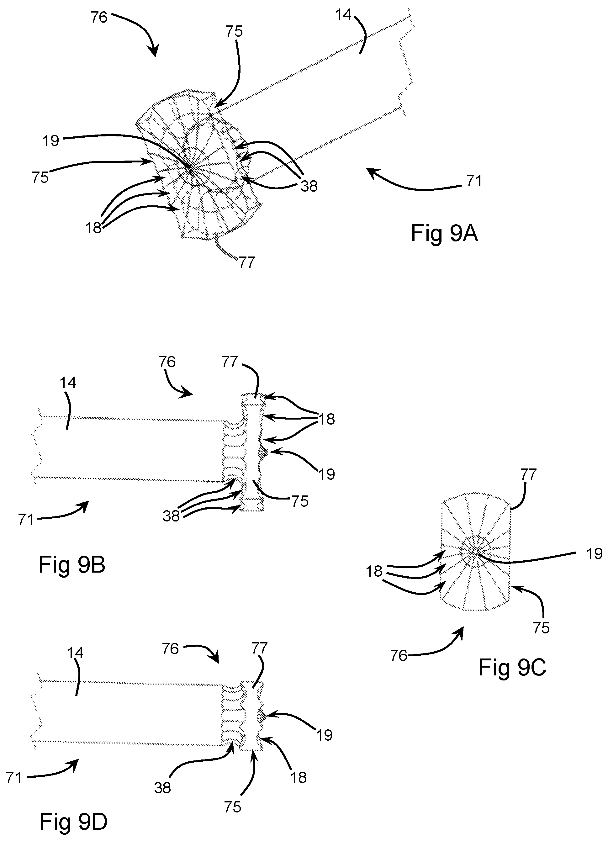 Patent US12396774 Figure 8 – Orthopaedic cement removal tools and method