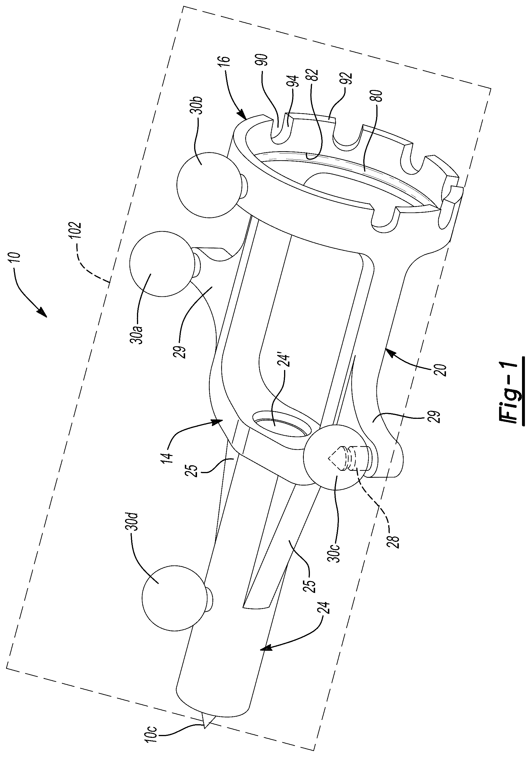 Patent US12396775 Figure 1 – System and method for positioning a tracking device