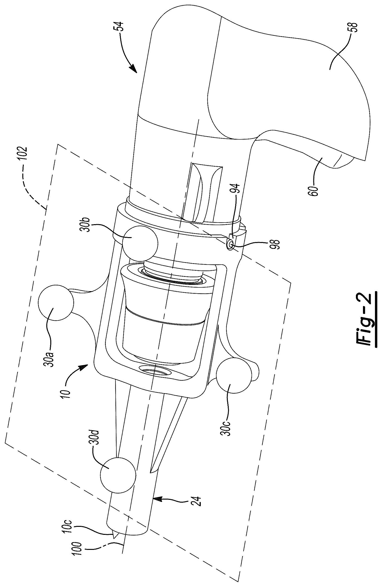 Patent US12396775 Figure 2 – System and method for positioning a tracking device