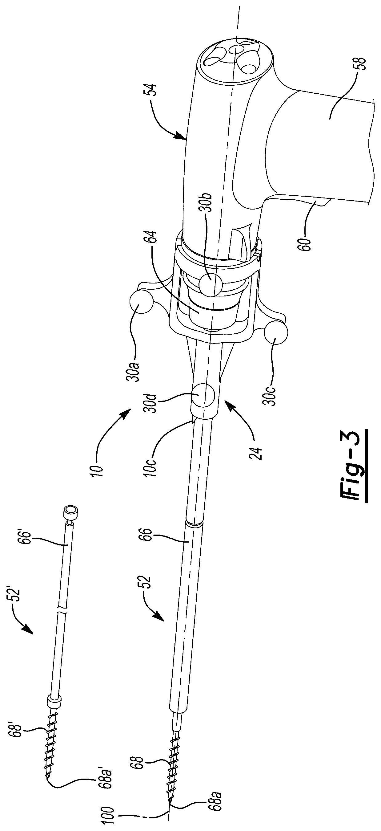Patent US12396775 Figure 3 – System and method for positioning a tracking device