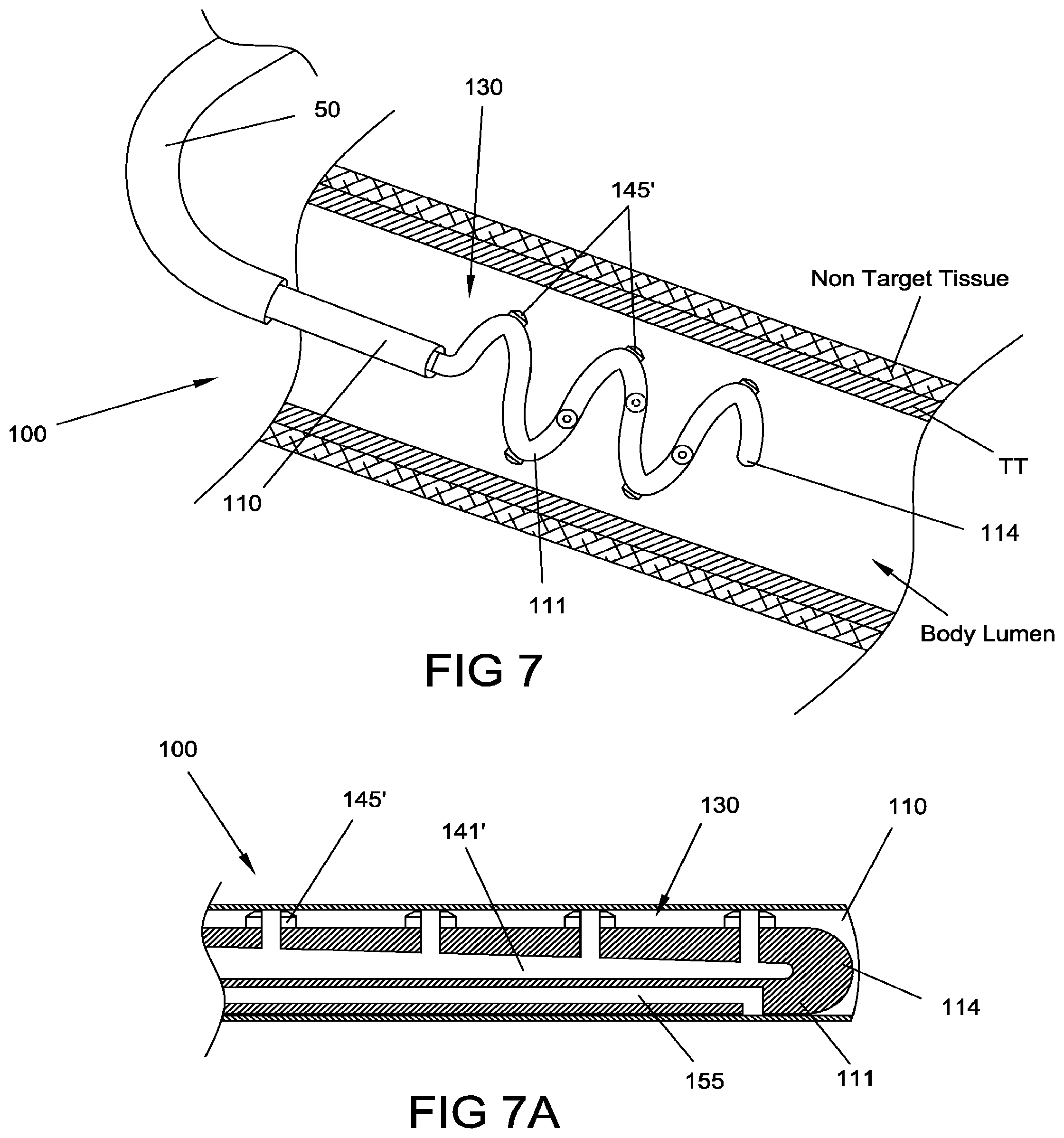 Patent US12396777 Figure 7 – Ablation systems, devices and methods for the treatment of tissue