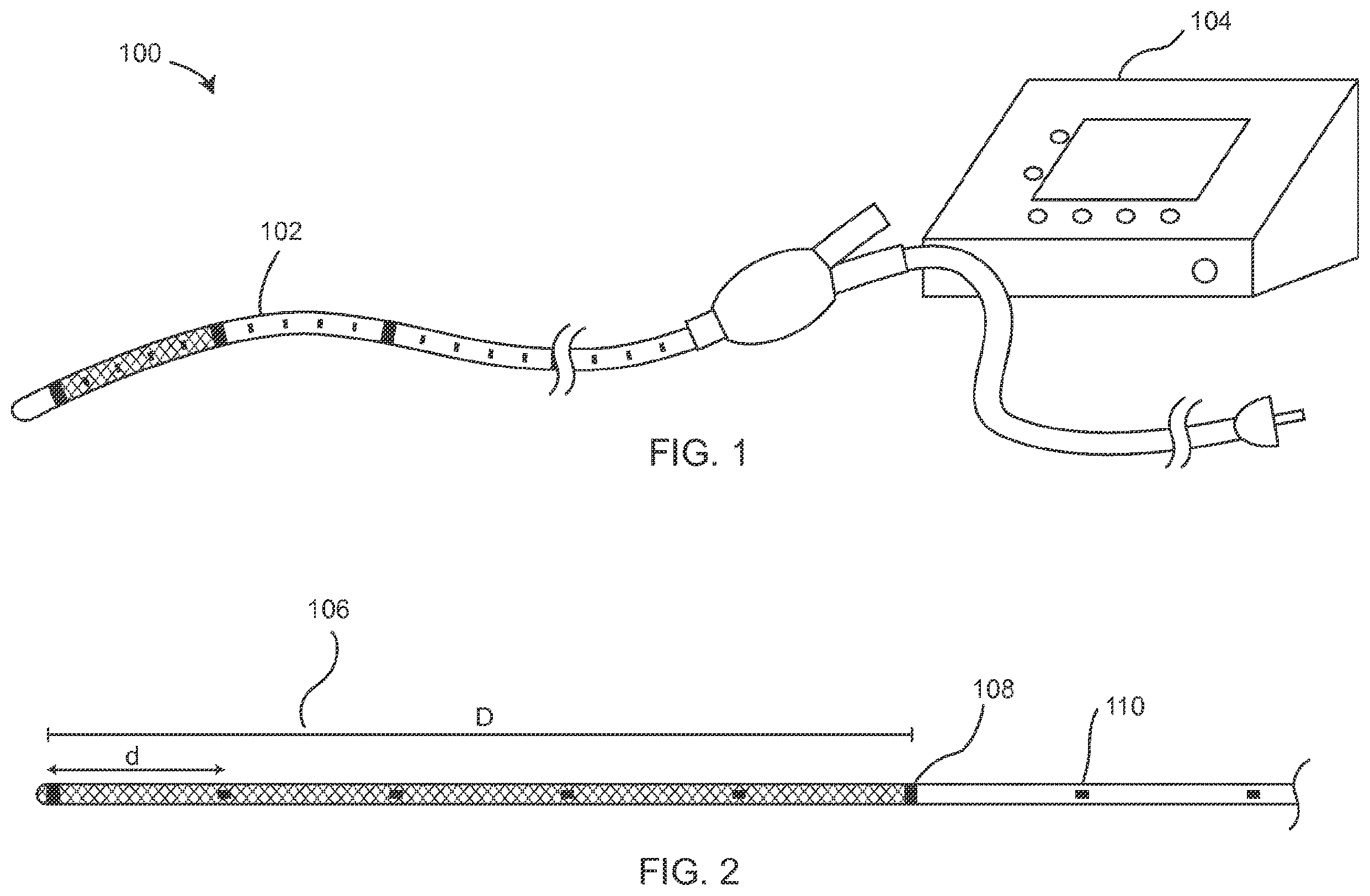 Patent US12396778 Figure 1 – Venous disease treatment