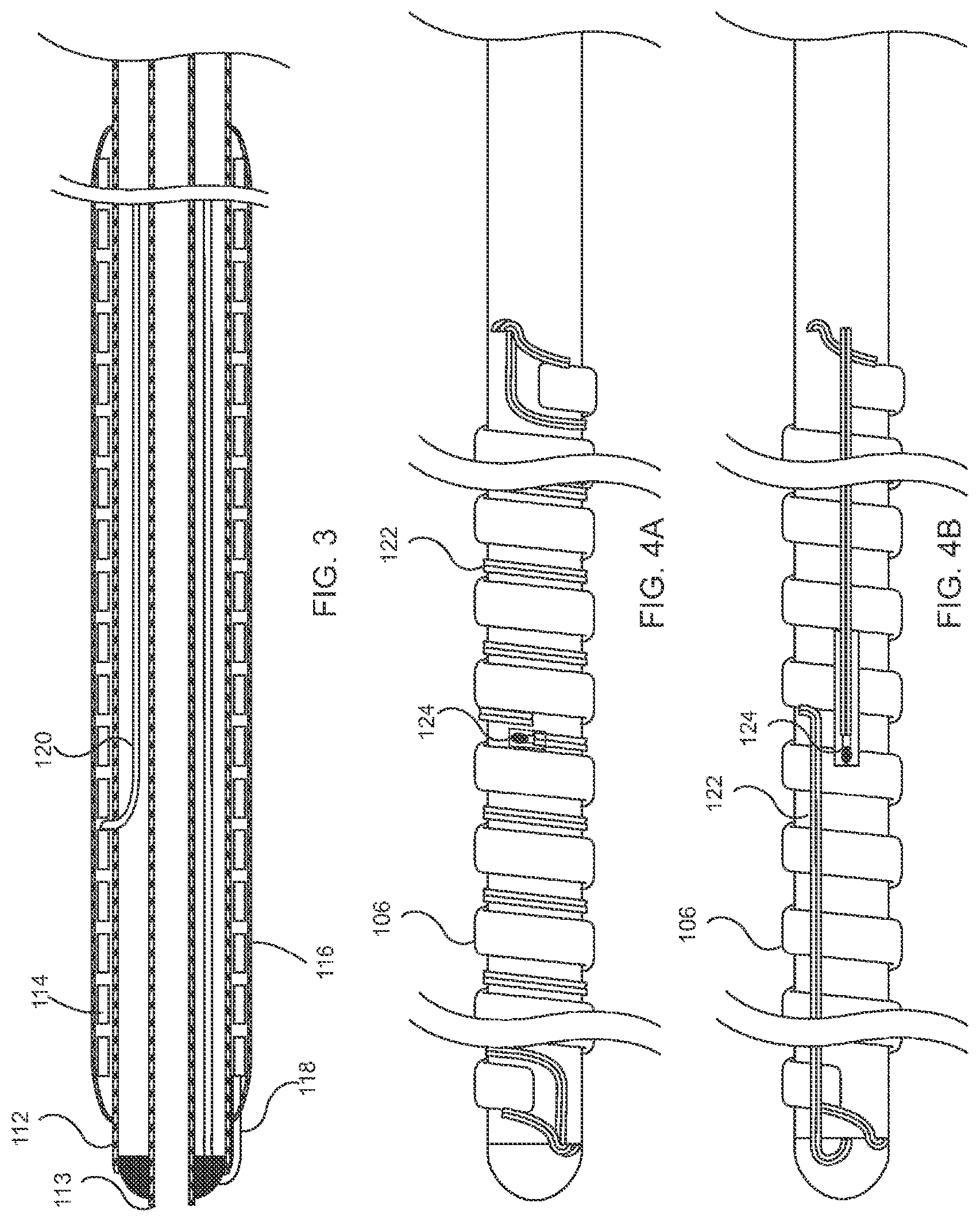 Patent US12396778 Figure 2 – Venous disease treatment