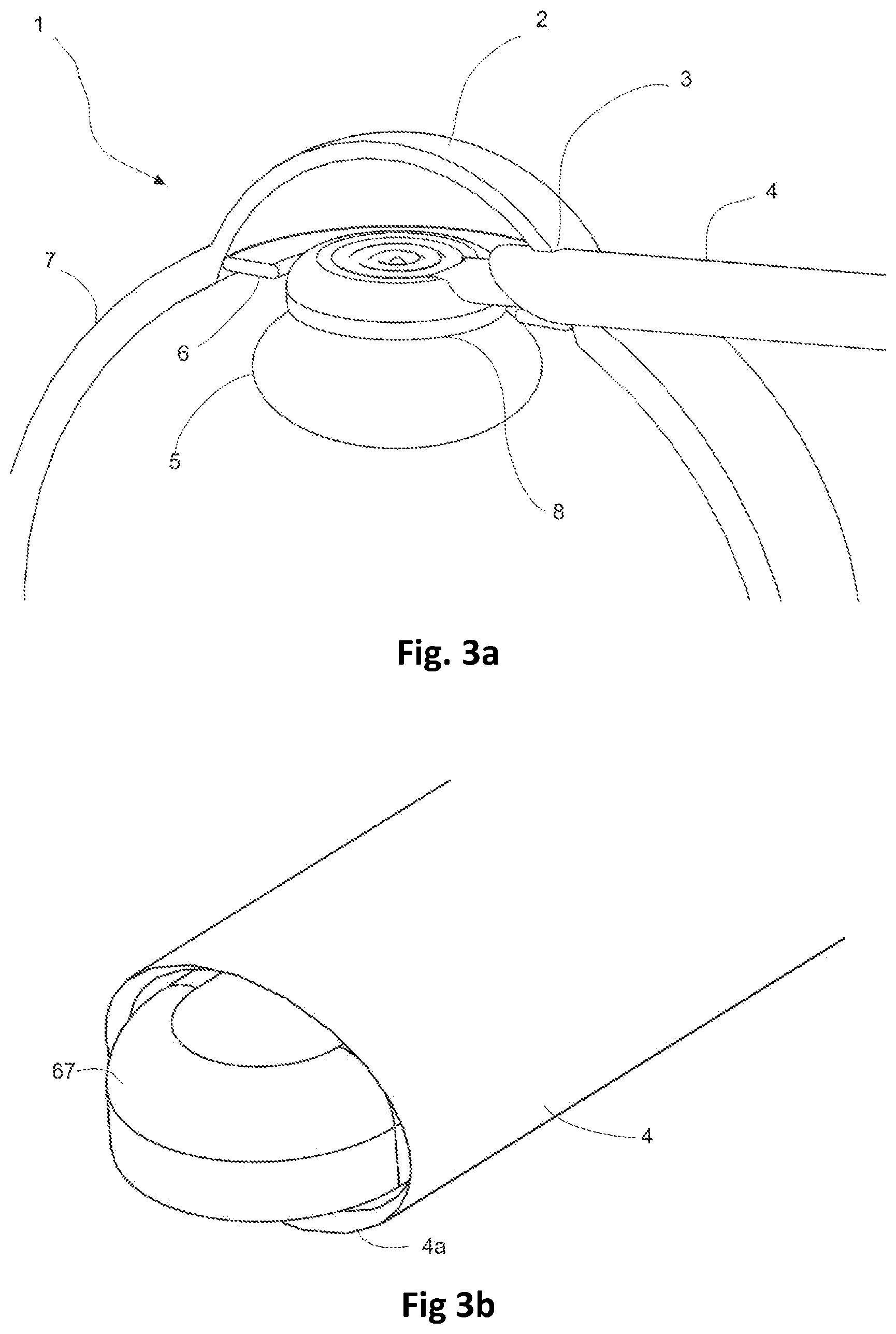 Patent US12396779 Figure 2 – Ophthalmic surgical device for capsulotomy