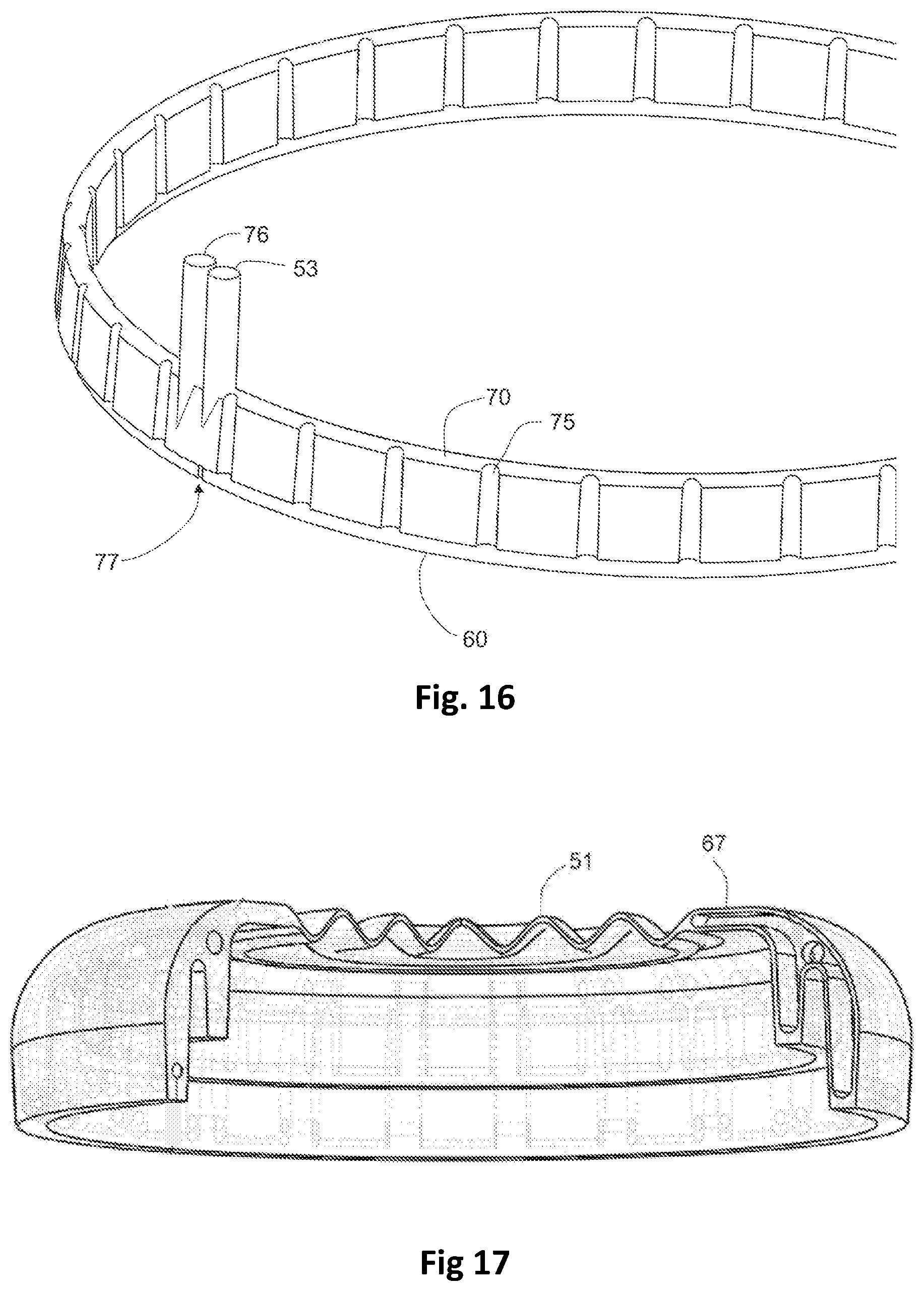 Patent US12396779 Figure 9 – Ophthalmic surgical device for capsulotomy