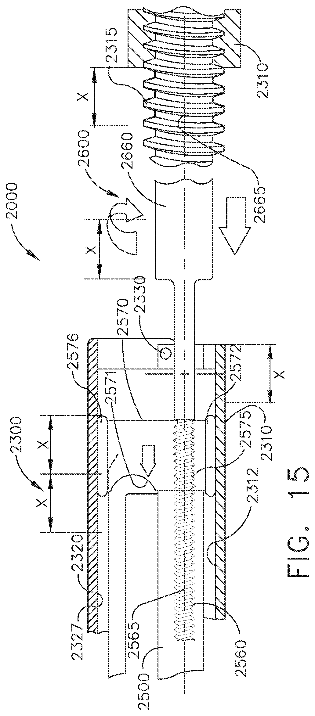 Patent US12396780 Figure 13 – Electrosurgical adaptation techniques of energy modality for combination electrosurgical instruments based on shorting or tissue impedance irregularity