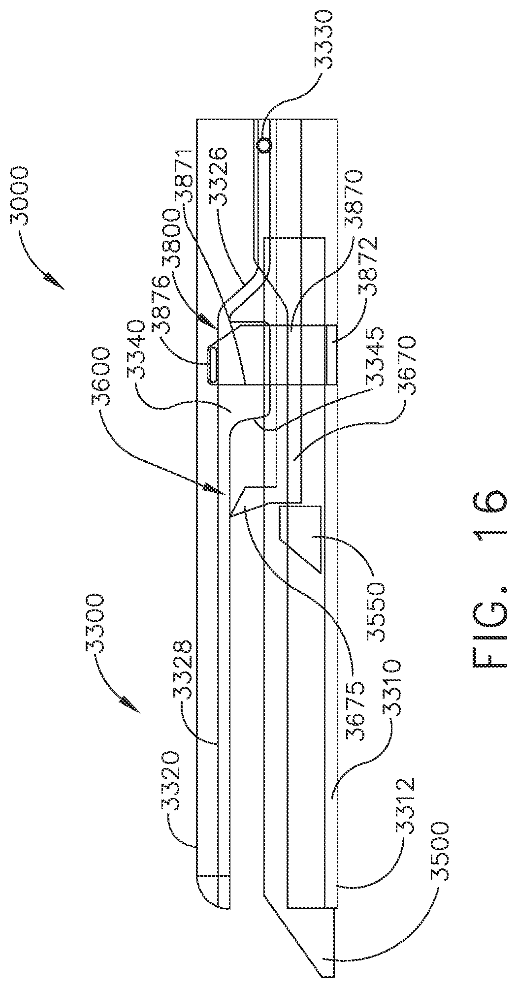 Patent US12396780 Figure 14 – Electrosurgical adaptation techniques of energy modality for combination electrosurgical instruments based on shorting or tissue impedance irregularity