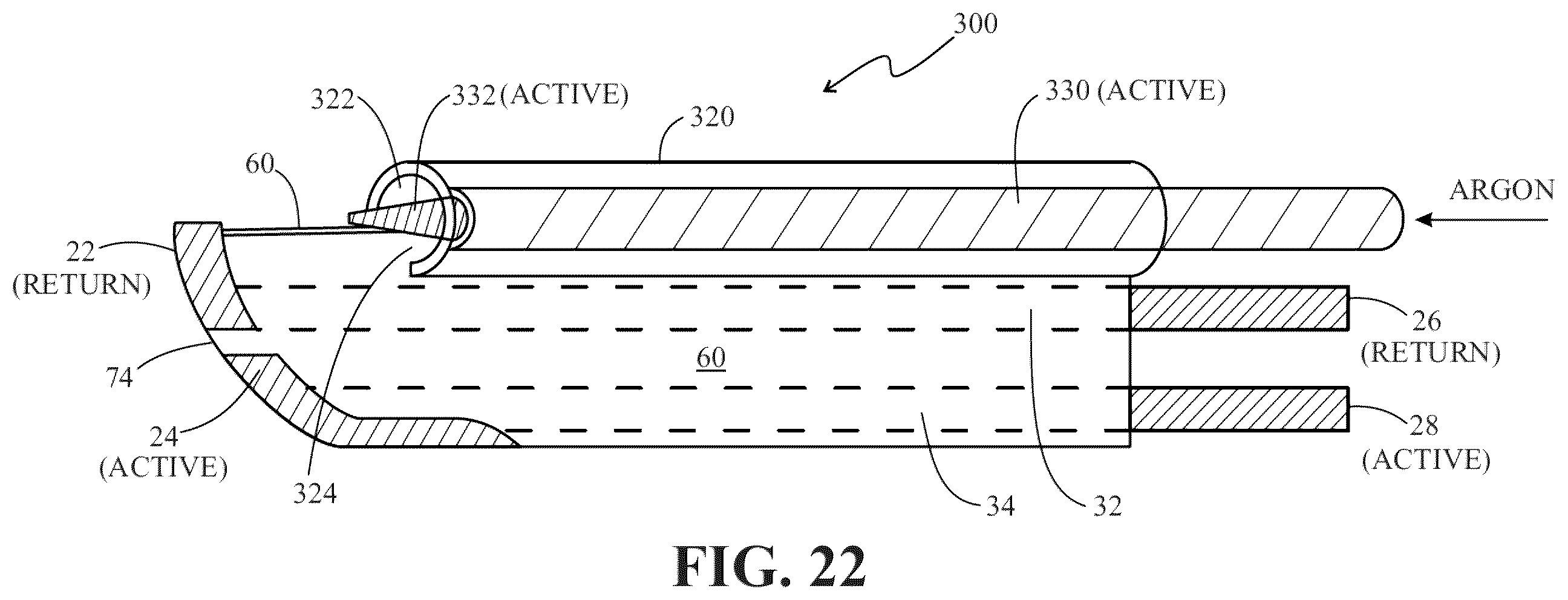 Patent US12396782 Figure 10 – Ultrapolar electrosurgery blade and ultrapolar electrosurgery blade assembly and method for making same