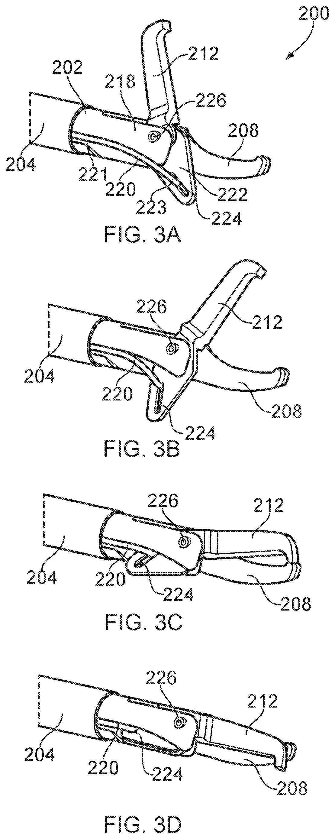 Patent US12396784 Figure 3 – Electrosurgical resector tool