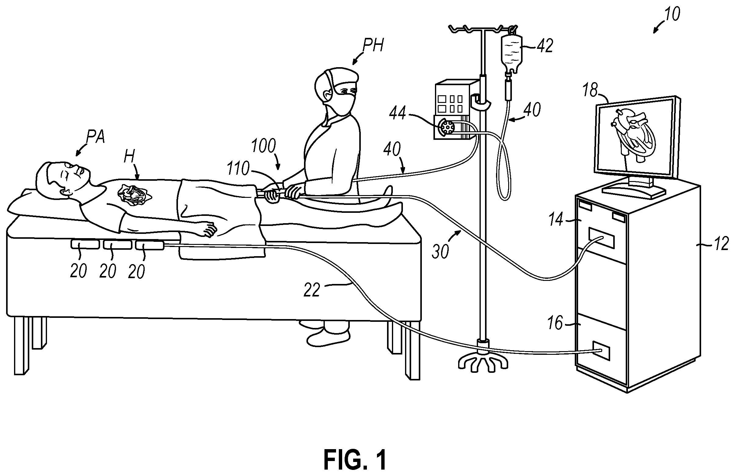 Patent US12396787 Figure 1 – Catheter with integrated thin-film microsensors