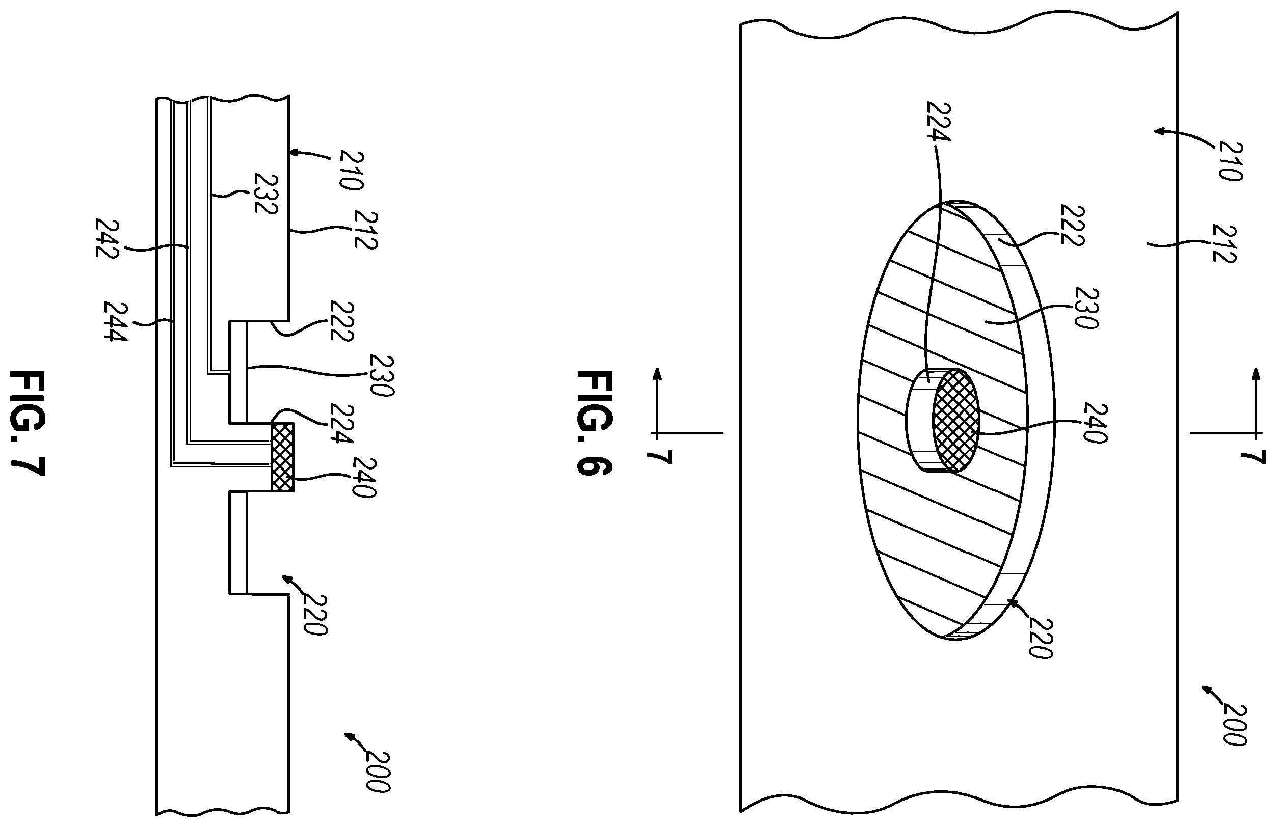 Patent US12396787 Figure 6 – Catheter with integrated thin-film microsensors