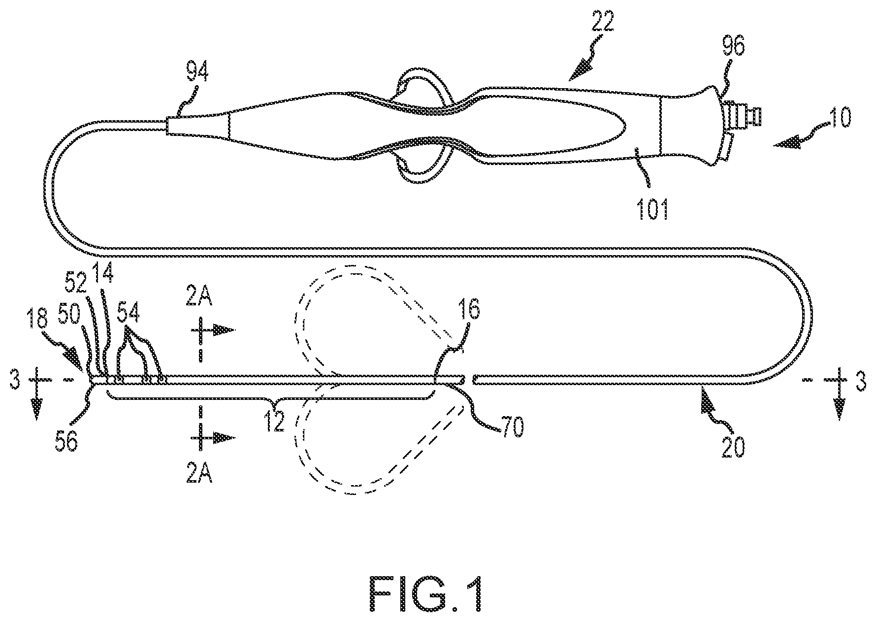 Patent US12396788 Figure 1 – Flex tip fluid lumen assembly with termination tube