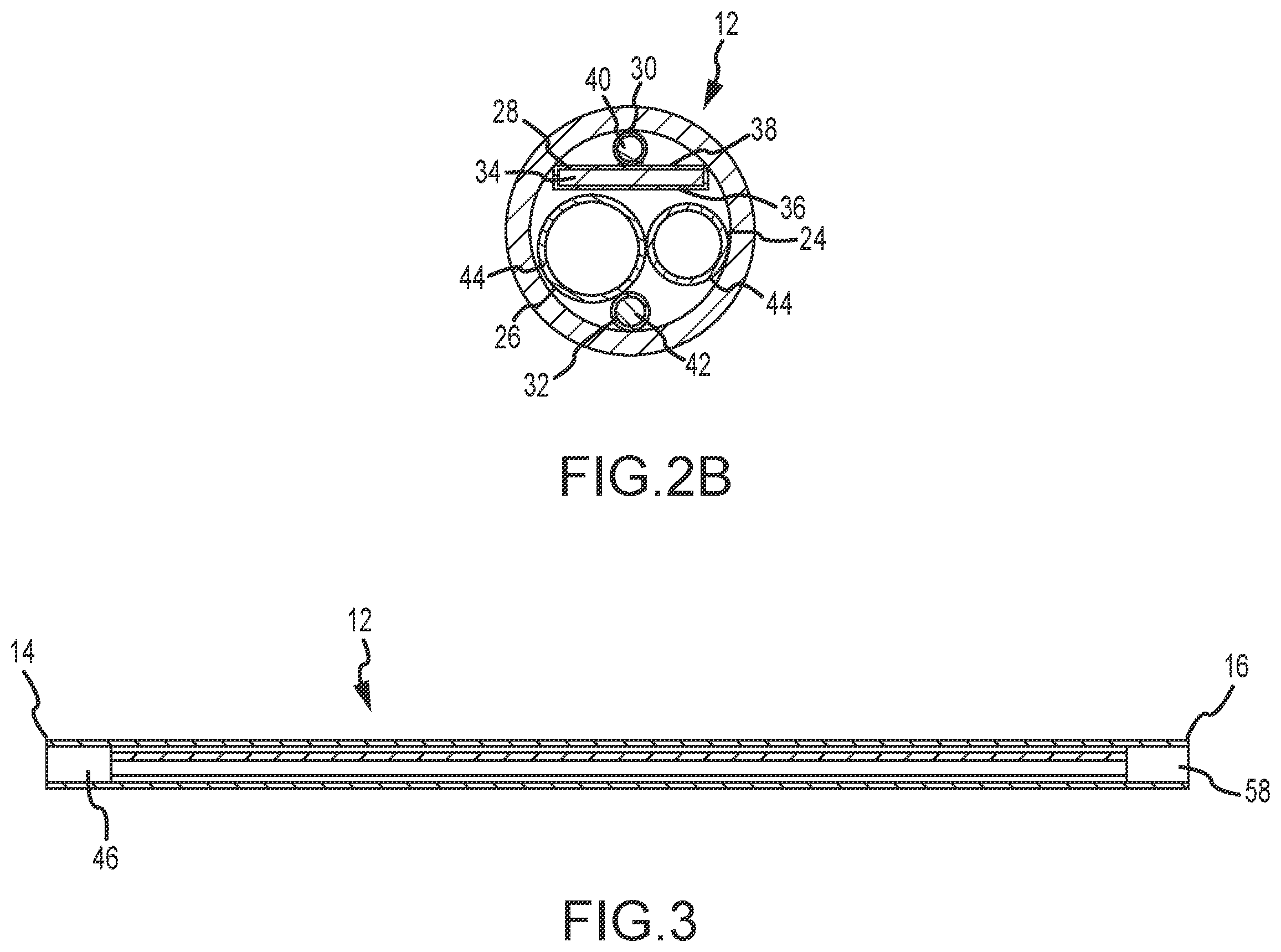 Patent US12396788 Figure 3 – Flex tip fluid lumen assembly with termination tube