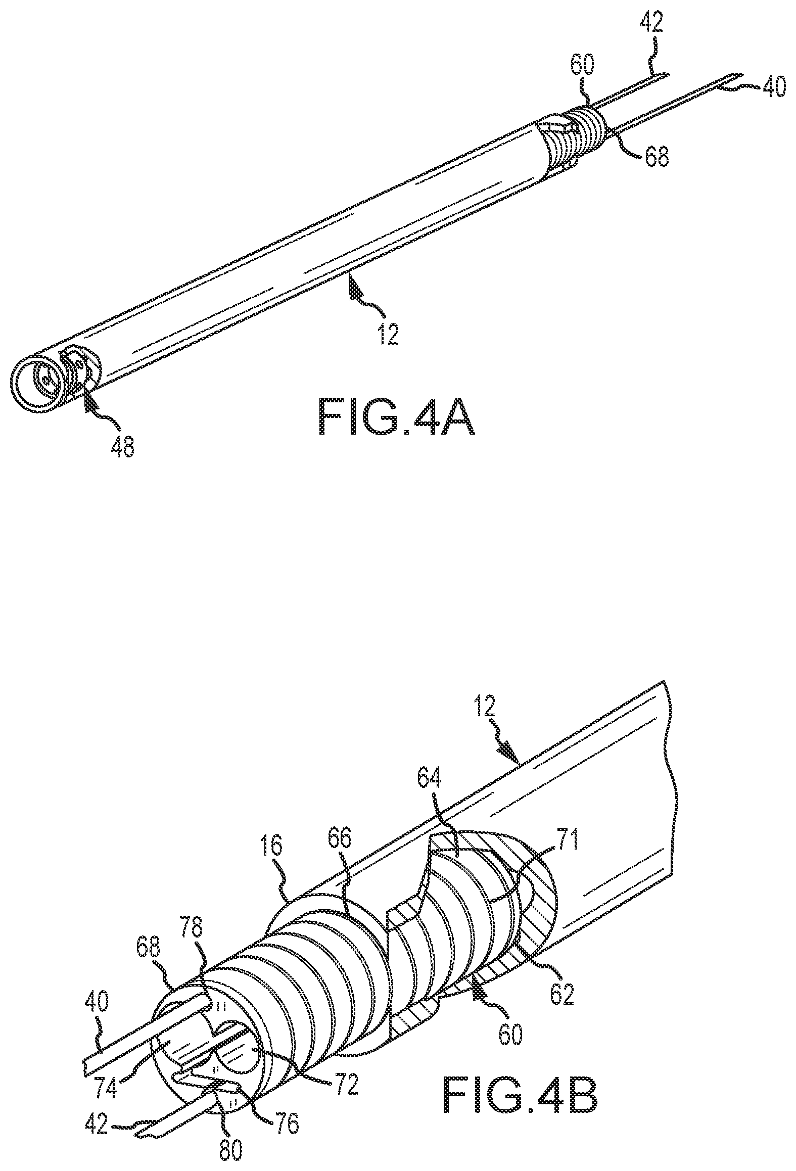 Patent US12396788 Figure 4 – Flex tip fluid lumen assembly with termination tube