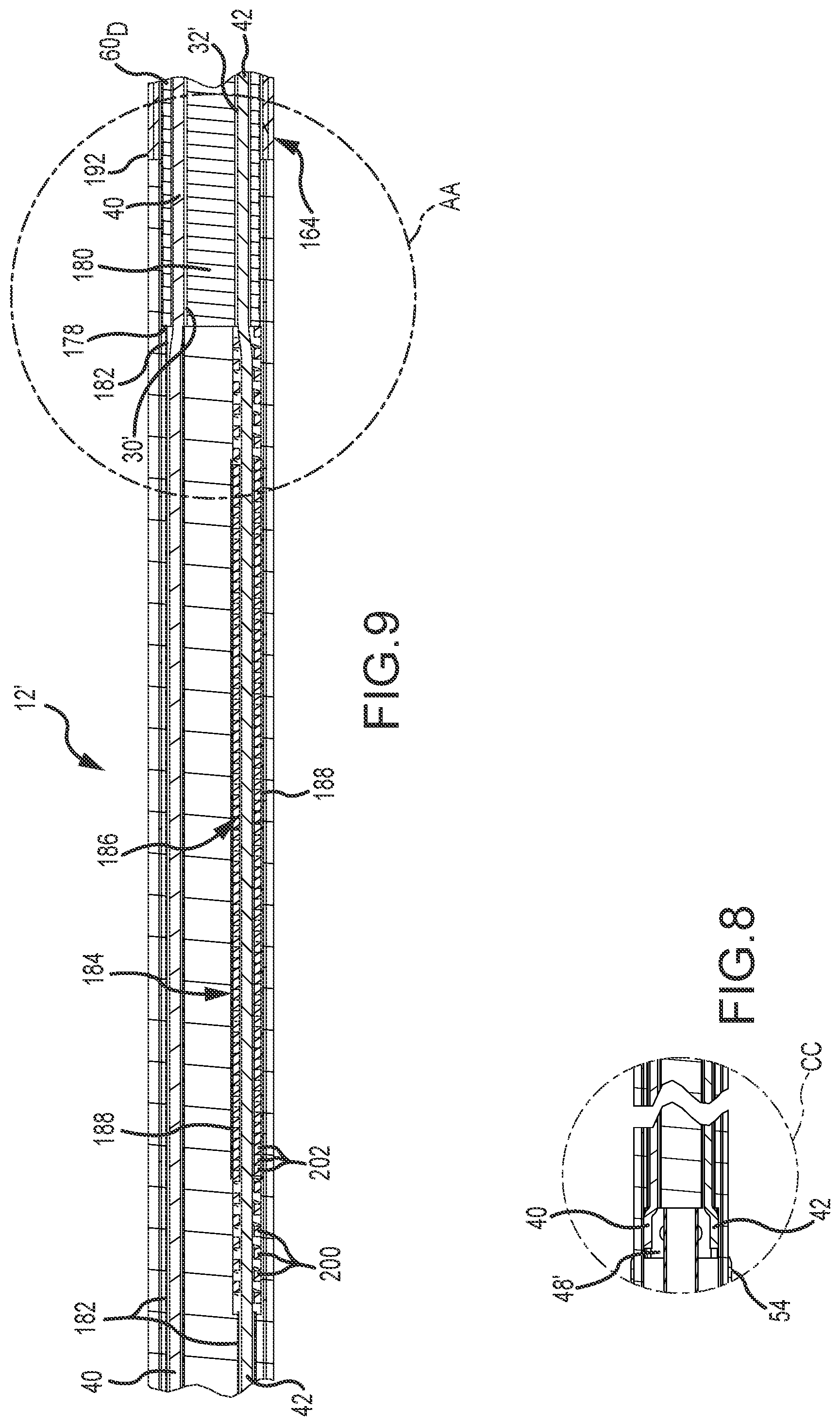 Patent US12396788 Figure 6 – Flex tip fluid lumen assembly with termination tube