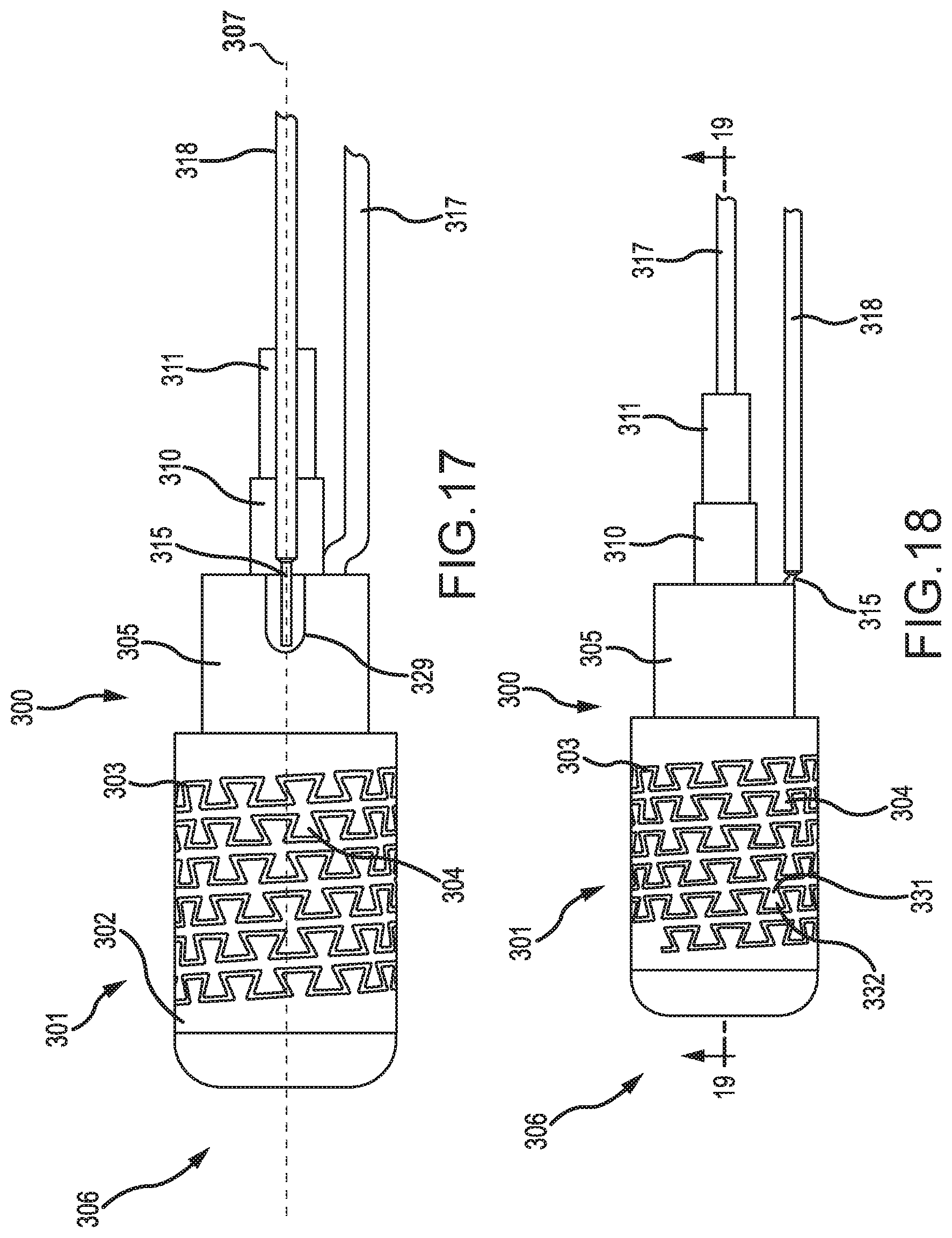 Patent US12396788 Figure 11 – Flex tip fluid lumen assembly with termination tube