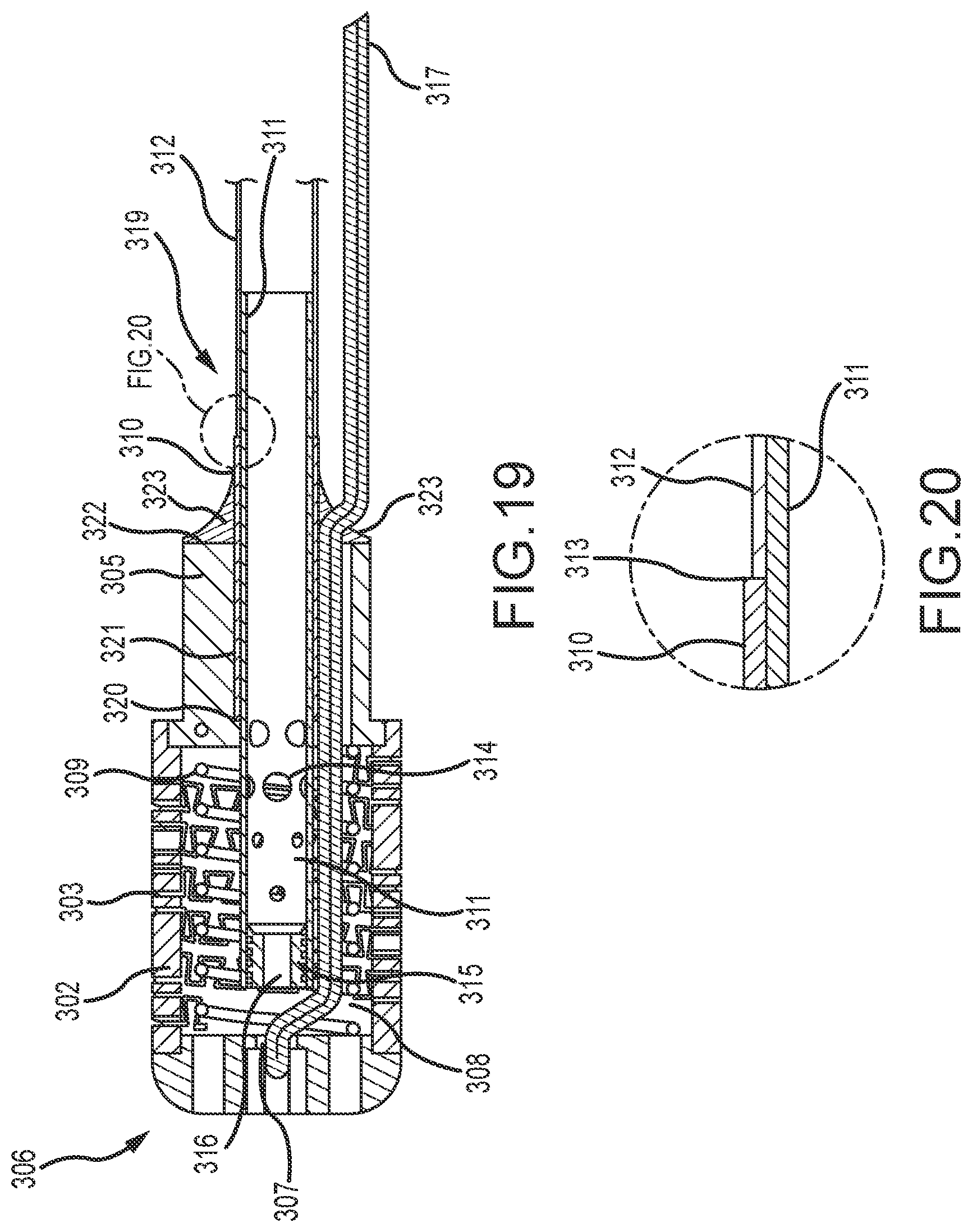Patent US12396788 Figure 12 – Flex tip fluid lumen assembly with termination tube