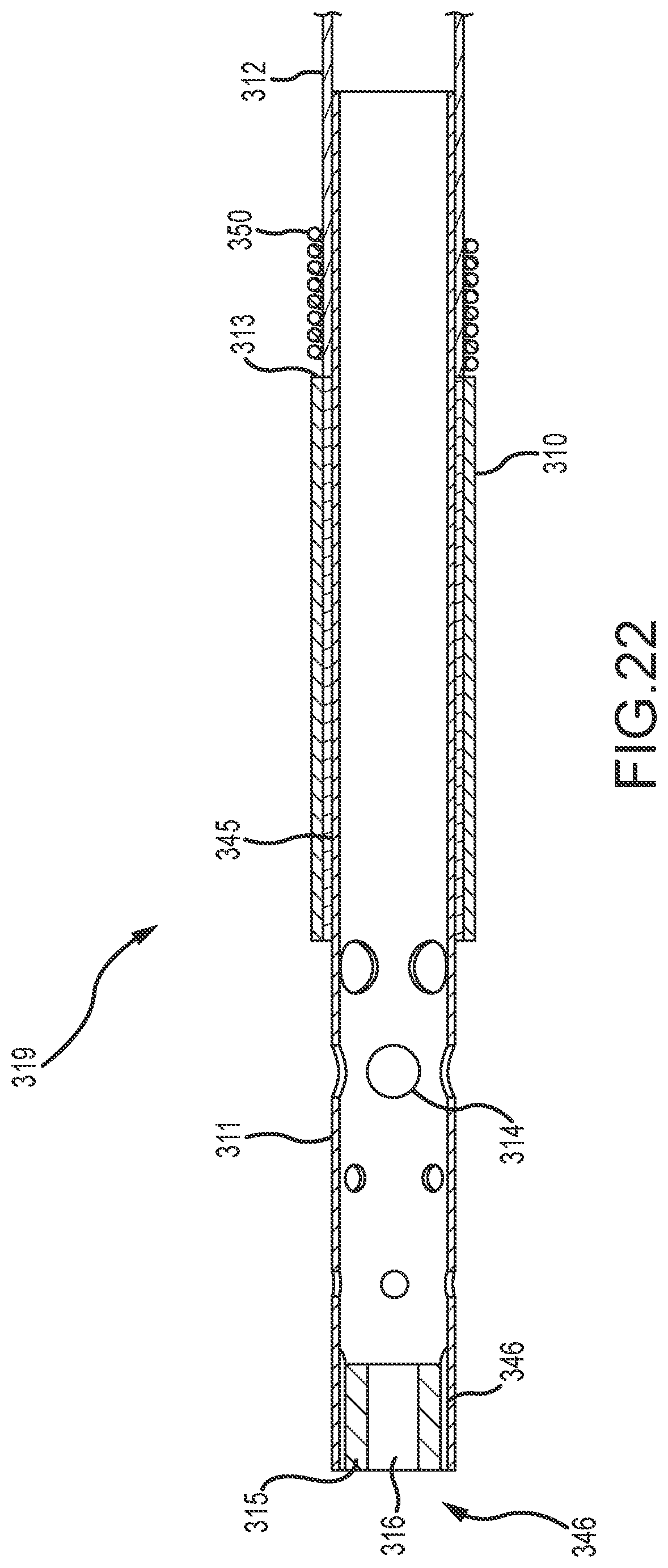 Patent US12396788 Figure 14 – Flex tip fluid lumen assembly with termination tube