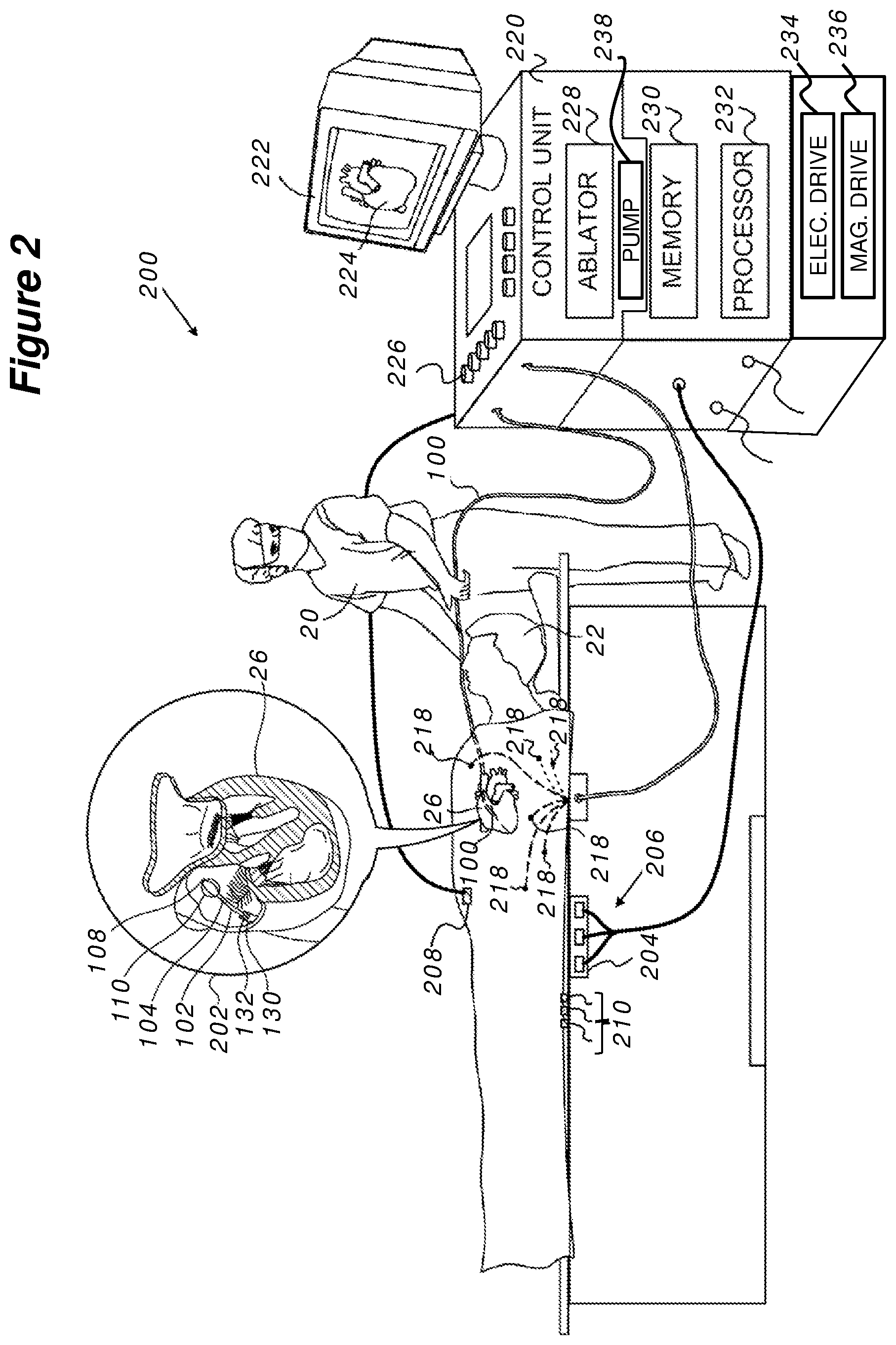 Patent US12396789 Figure 3 – Determining shape of expandable distal member of a catheter