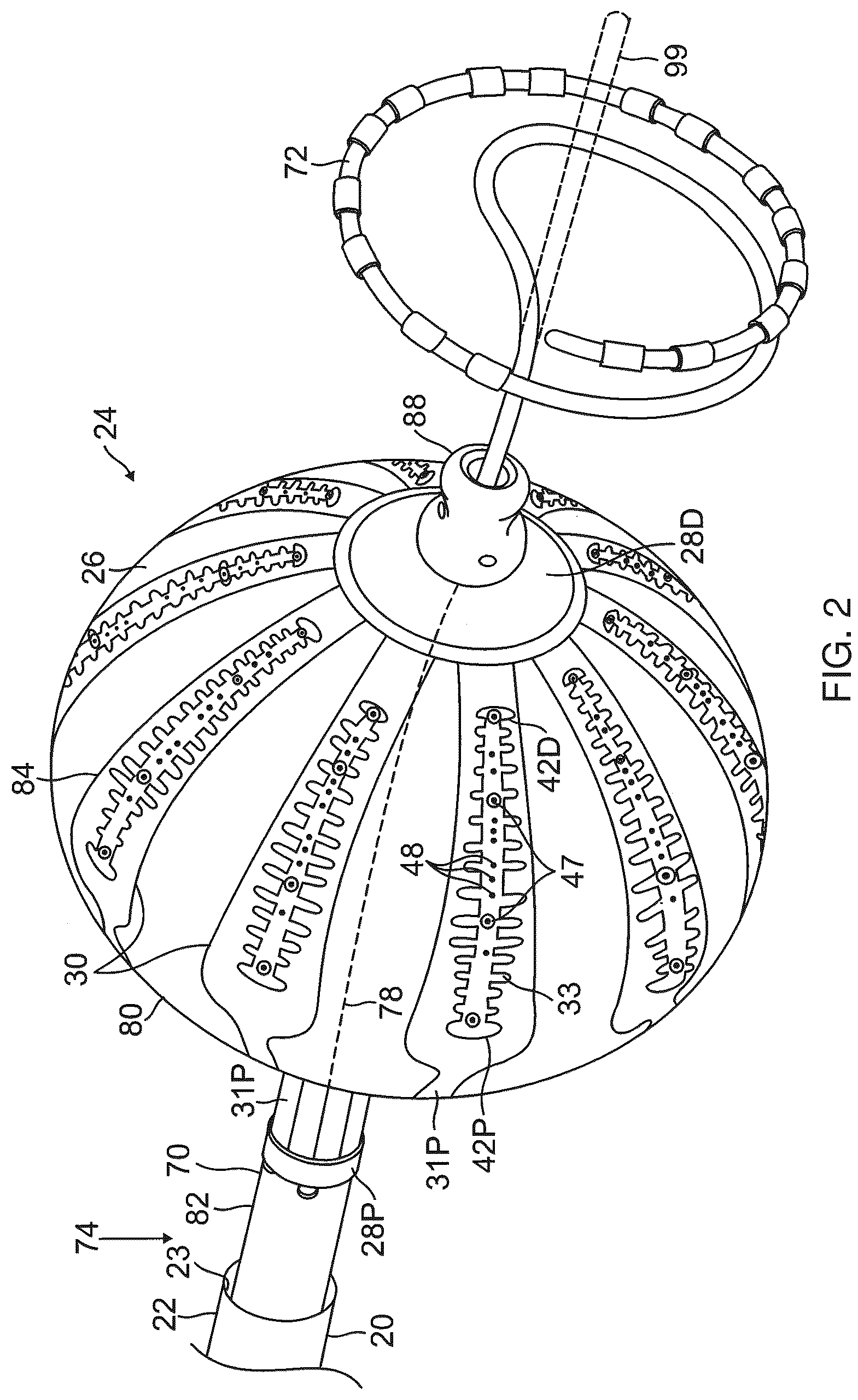 Patent US12396790 Figure 2 – Temperature controlled short duration ablation with multiple electrodes