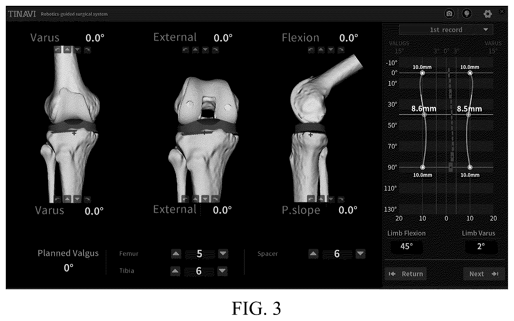 Patent US12396794 Figure 3 – Total knee arthroplasty robot auxiliary system, control method and electronic device