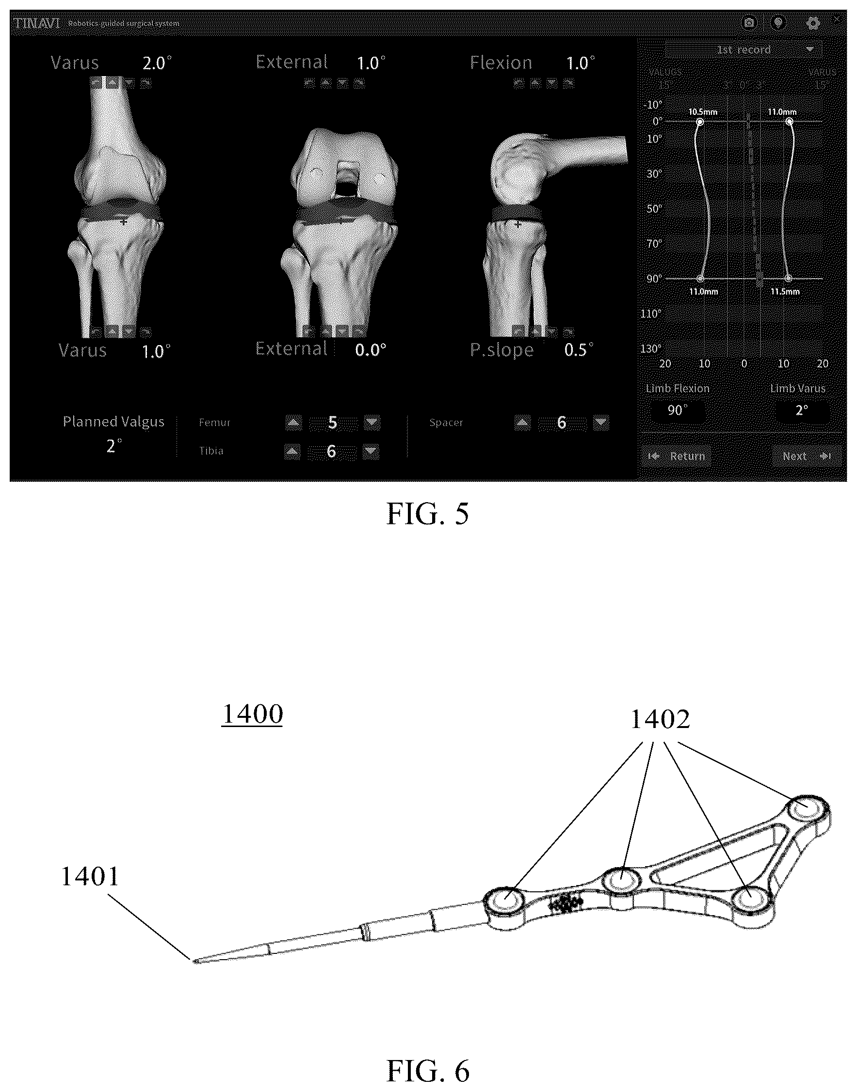 Patent US12396794 Figure 5 – Total knee arthroplasty robot auxiliary system, control method and electronic device