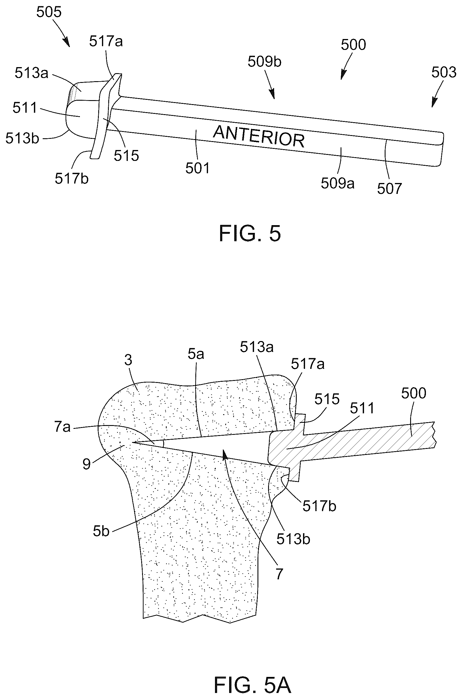 Patent US12396796 Figure 8 – Surgical kit for knee osteotomies and corresponding preoperative planning method