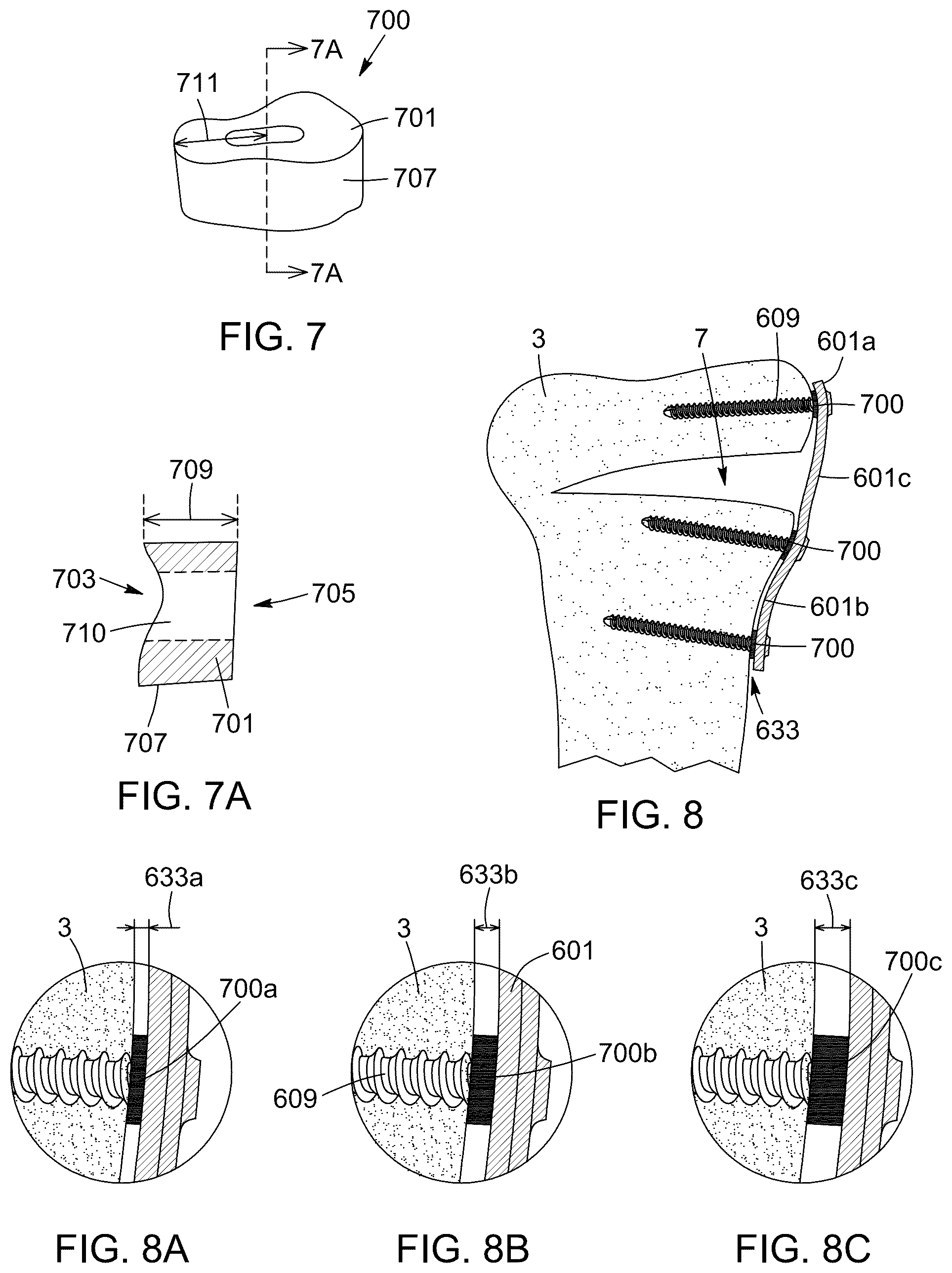 Patent US12396796 Figure 10 – Surgical kit for knee osteotomies and corresponding preoperative planning method