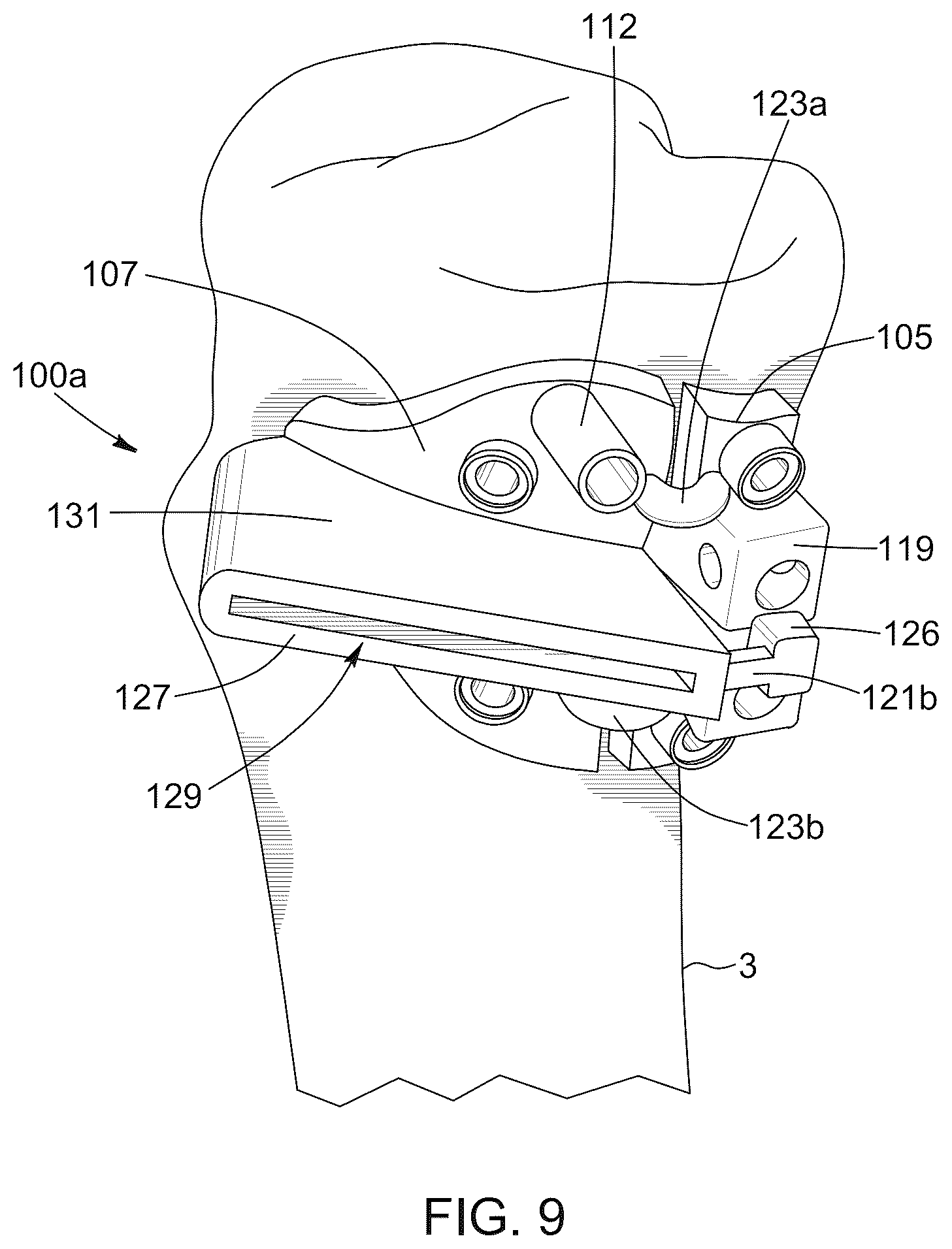 Patent US12396796 Figure 11 – Surgical kit for knee osteotomies and corresponding preoperative planning method