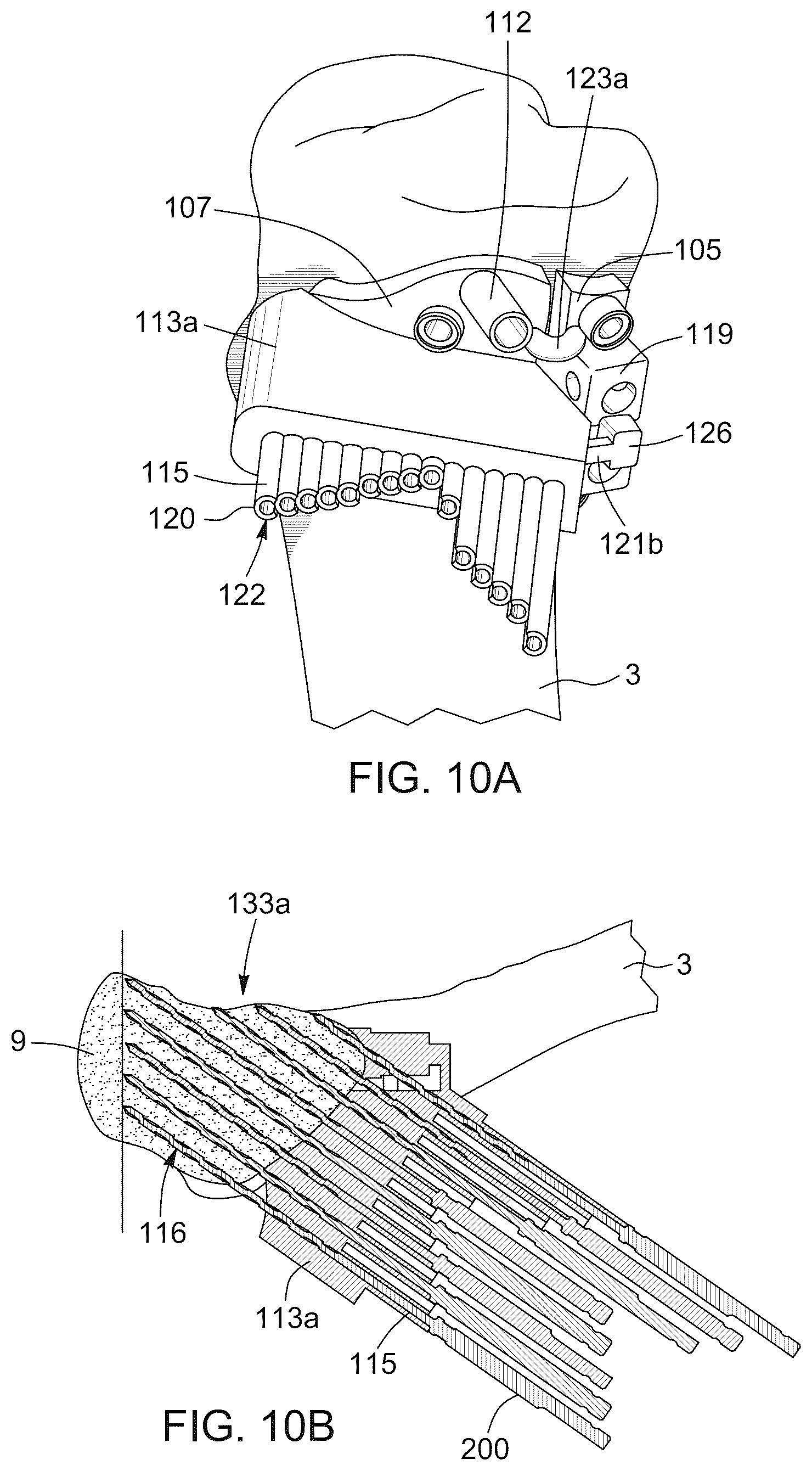 Patent US12396796 Figure 12 – Surgical kit for knee osteotomies and corresponding preoperative planning method