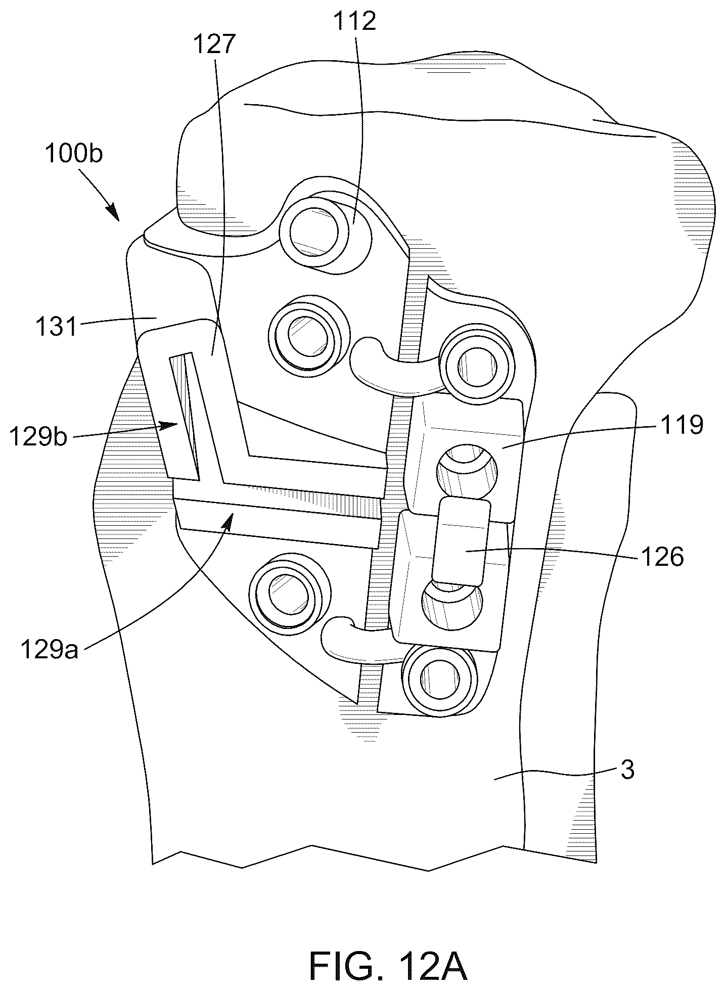 Patent US12396796 Figure 14 – Surgical kit for knee osteotomies and corresponding preoperative planning method
