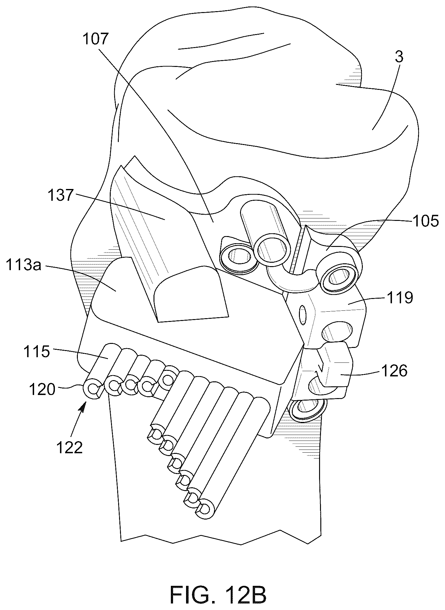 Patent US12396796 Figure 15 – Surgical kit for knee osteotomies and corresponding preoperative planning method