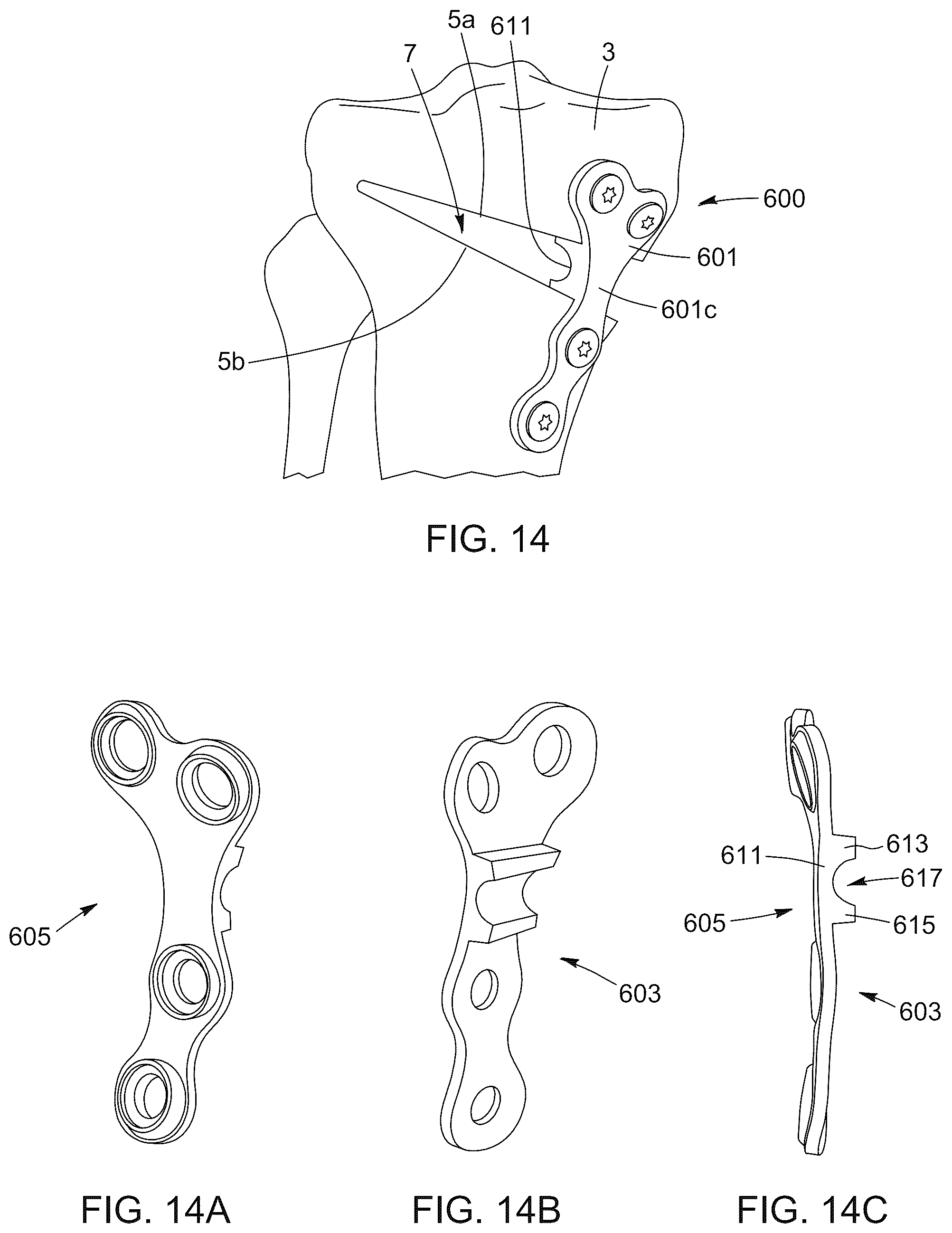 Patent US12396796 Figure 19 – Surgical kit for knee osteotomies and corresponding preoperative planning method