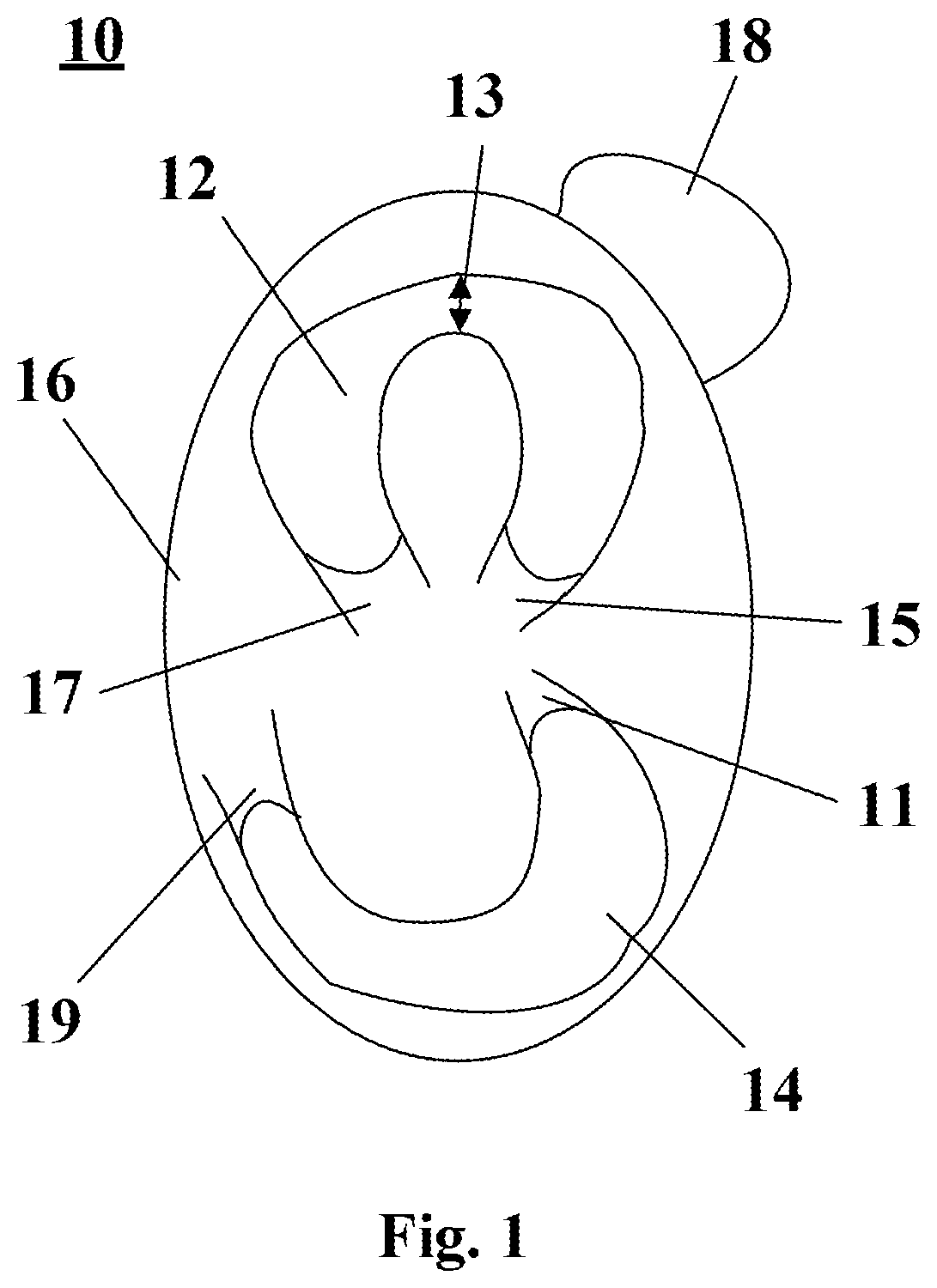 Patent US12396797 Figure 1 – System and methods of manufacturing a lateral meniscus implant
