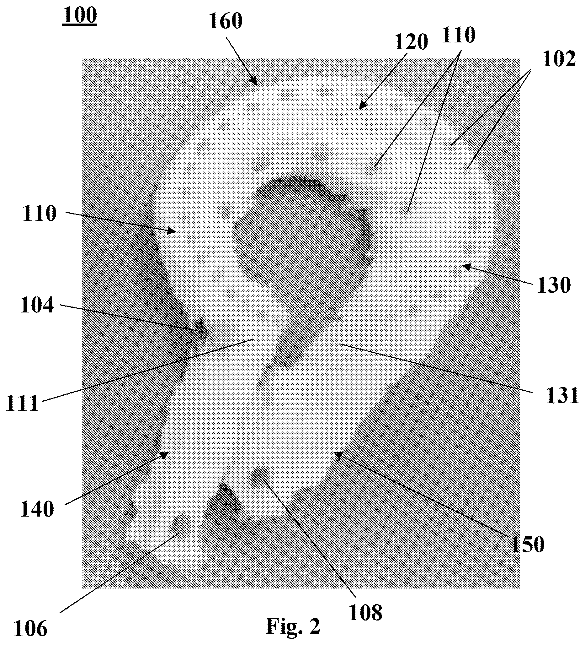 Patent US12396797 Figure 2 – System and methods of manufacturing a lateral meniscus implant