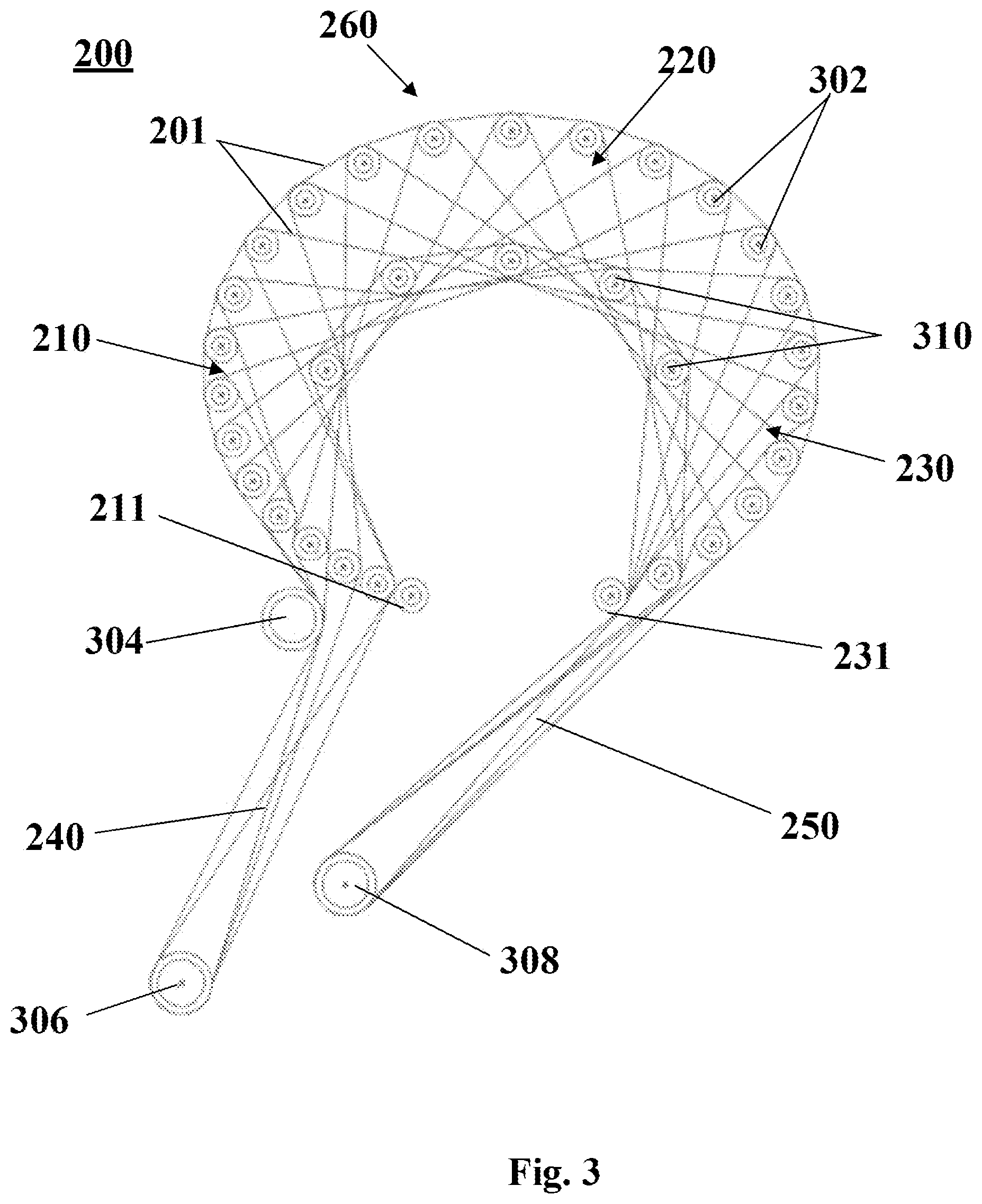 Patent US12396797 Figure 3 – System and methods of manufacturing a lateral meniscus implant