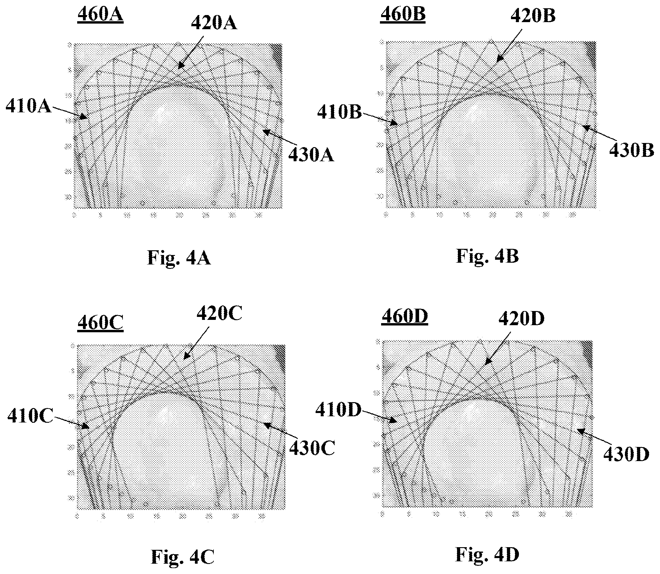 Patent US12396797 Figure 4 – System and methods of manufacturing a lateral meniscus implant