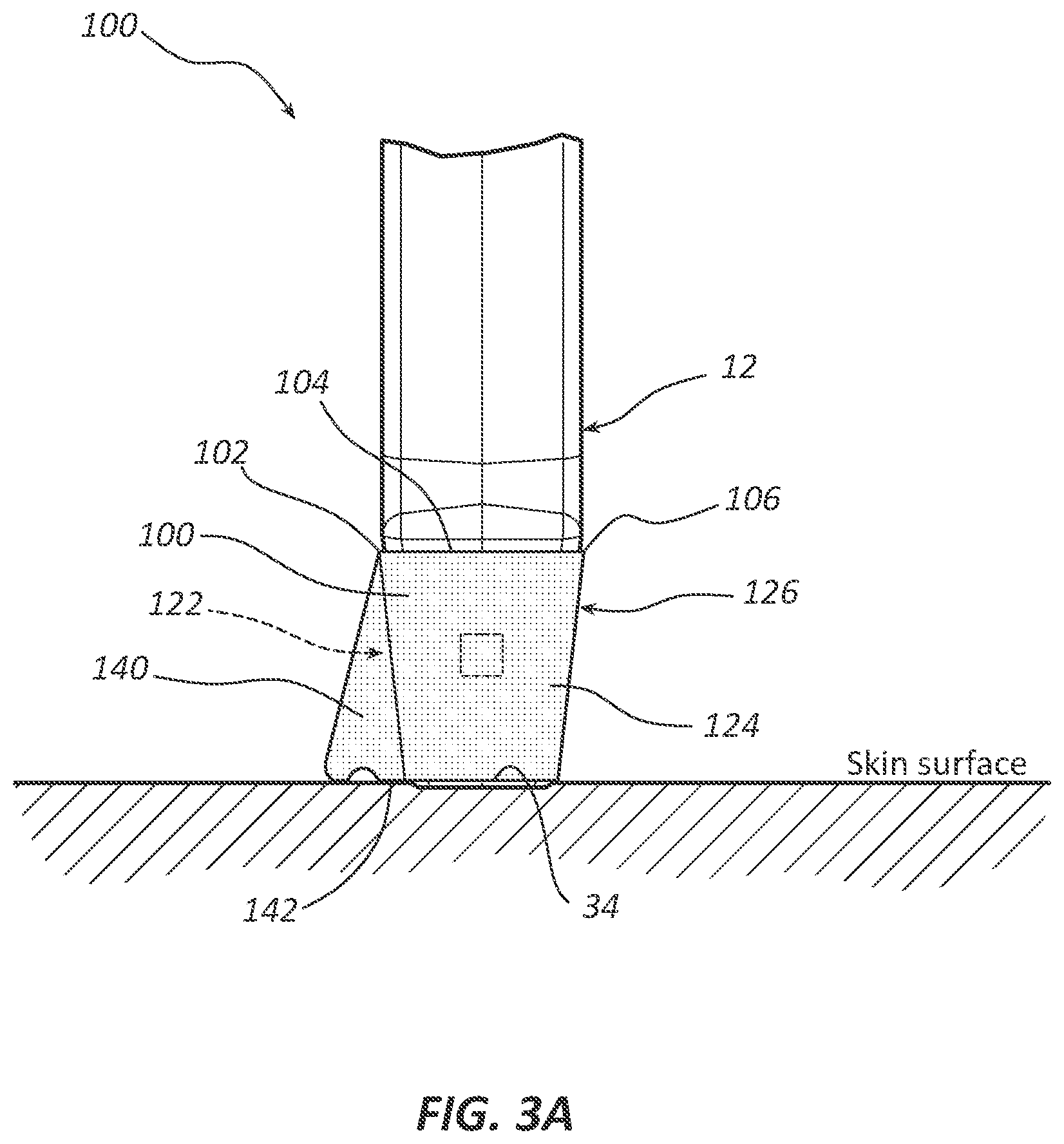 Patent US12396798 Figure 4 – Probe shield