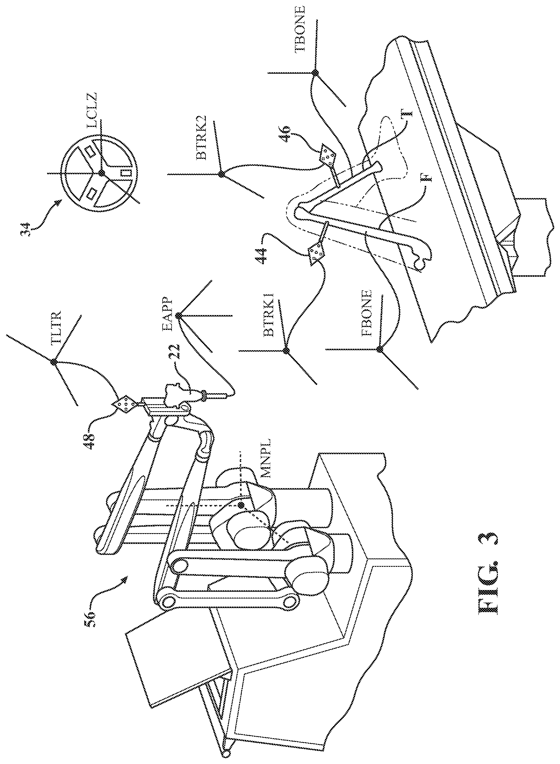 Patent US12396802 Figure 3 – Systems and methods for establishing virtual constraint boundaries