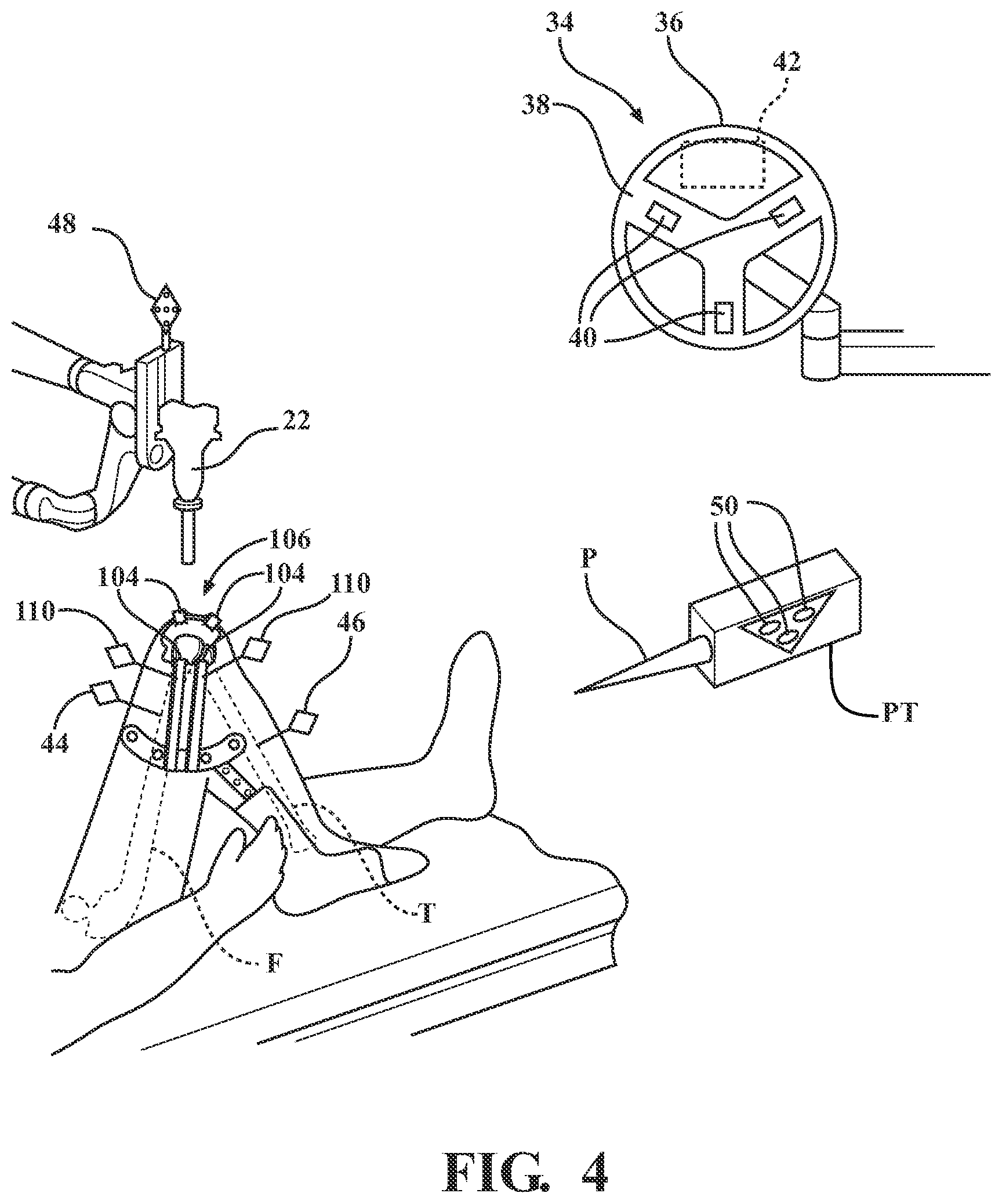 Patent US12396802 Figure 4 – Systems and methods for establishing virtual constraint boundaries