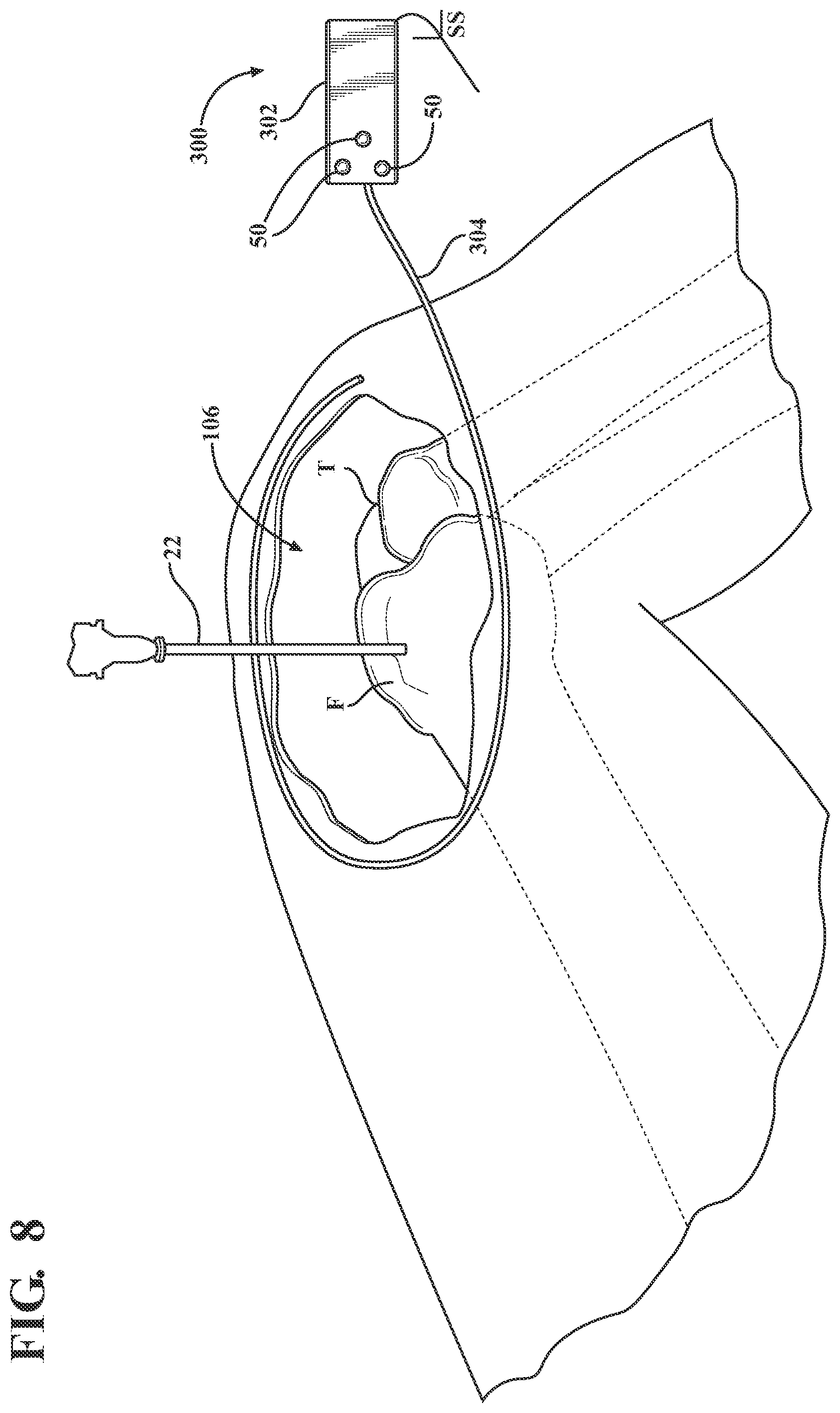 Patent US12396802 Figure 6 – Systems and methods for establishing virtual constraint boundaries