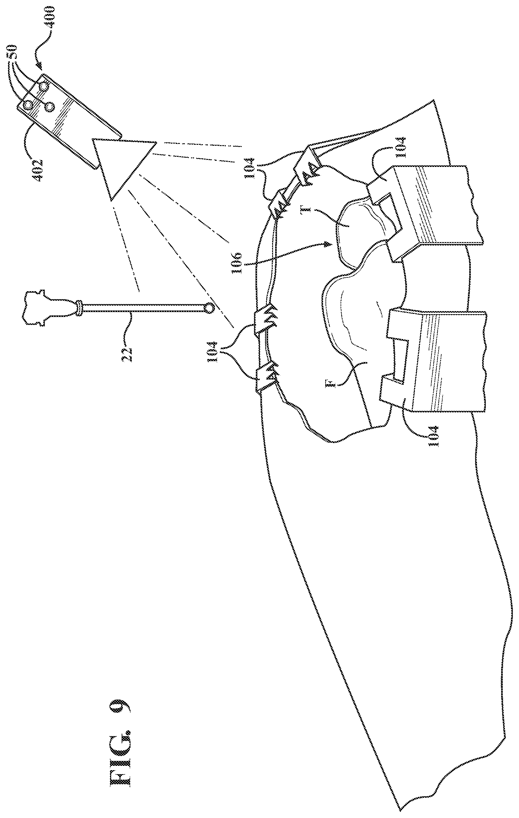 Patent US12396802 Figure 7 – Systems and methods for establishing virtual constraint boundaries